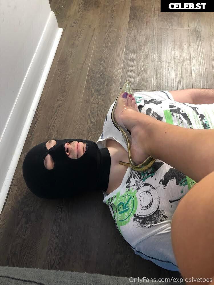 explosivetoess Image 17773030