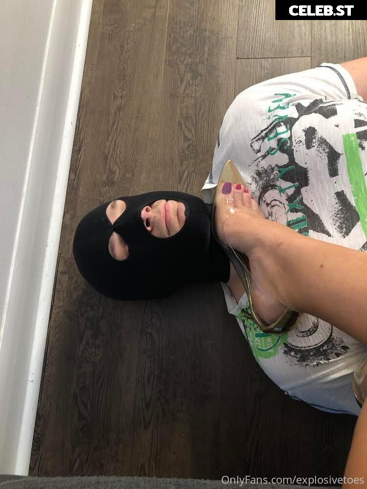 explosivetoess Image 17773073