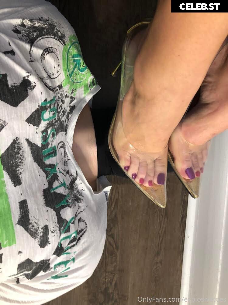 explosivetoess Image 17773077