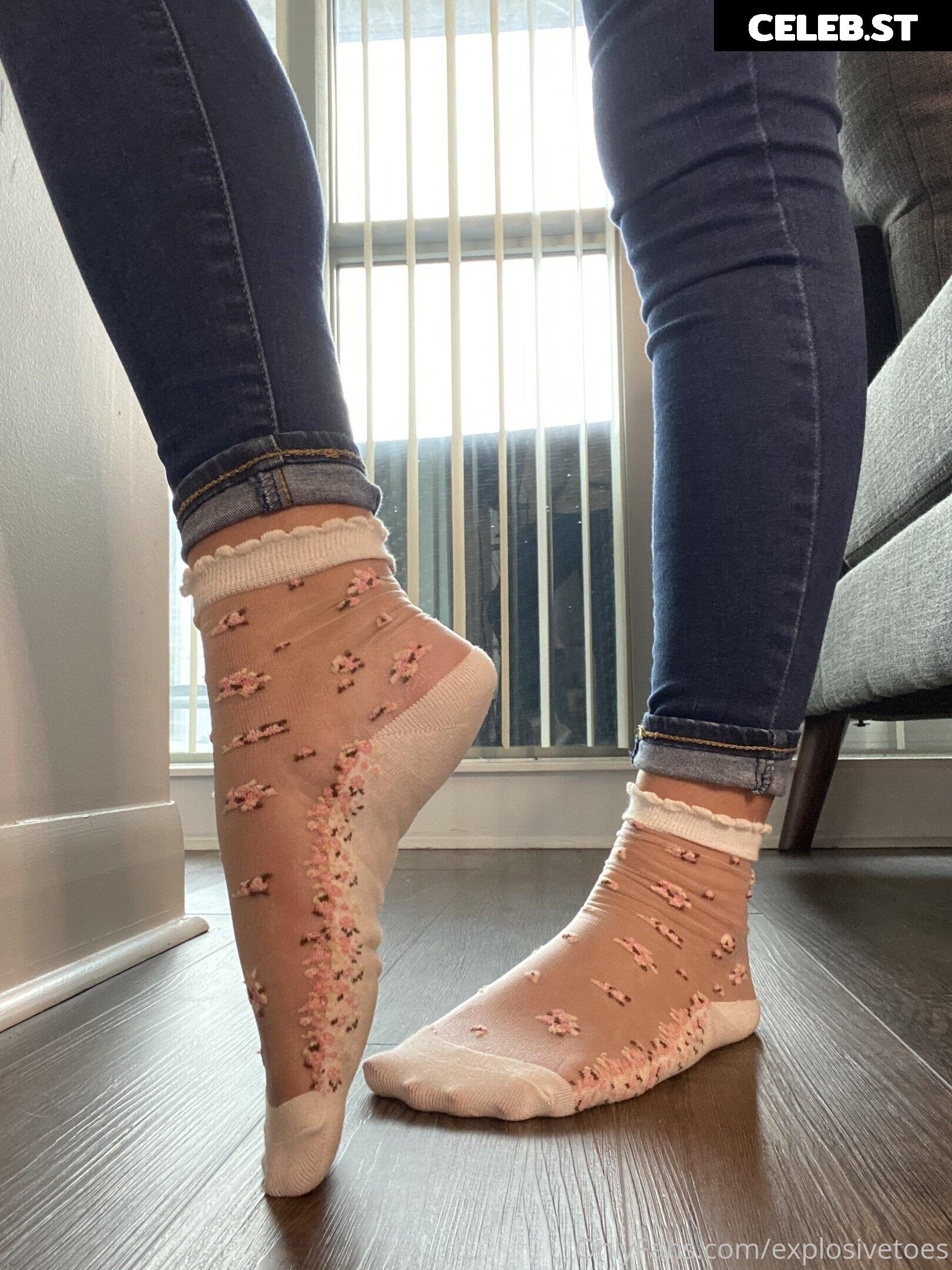 explosivetoess Image 17773211