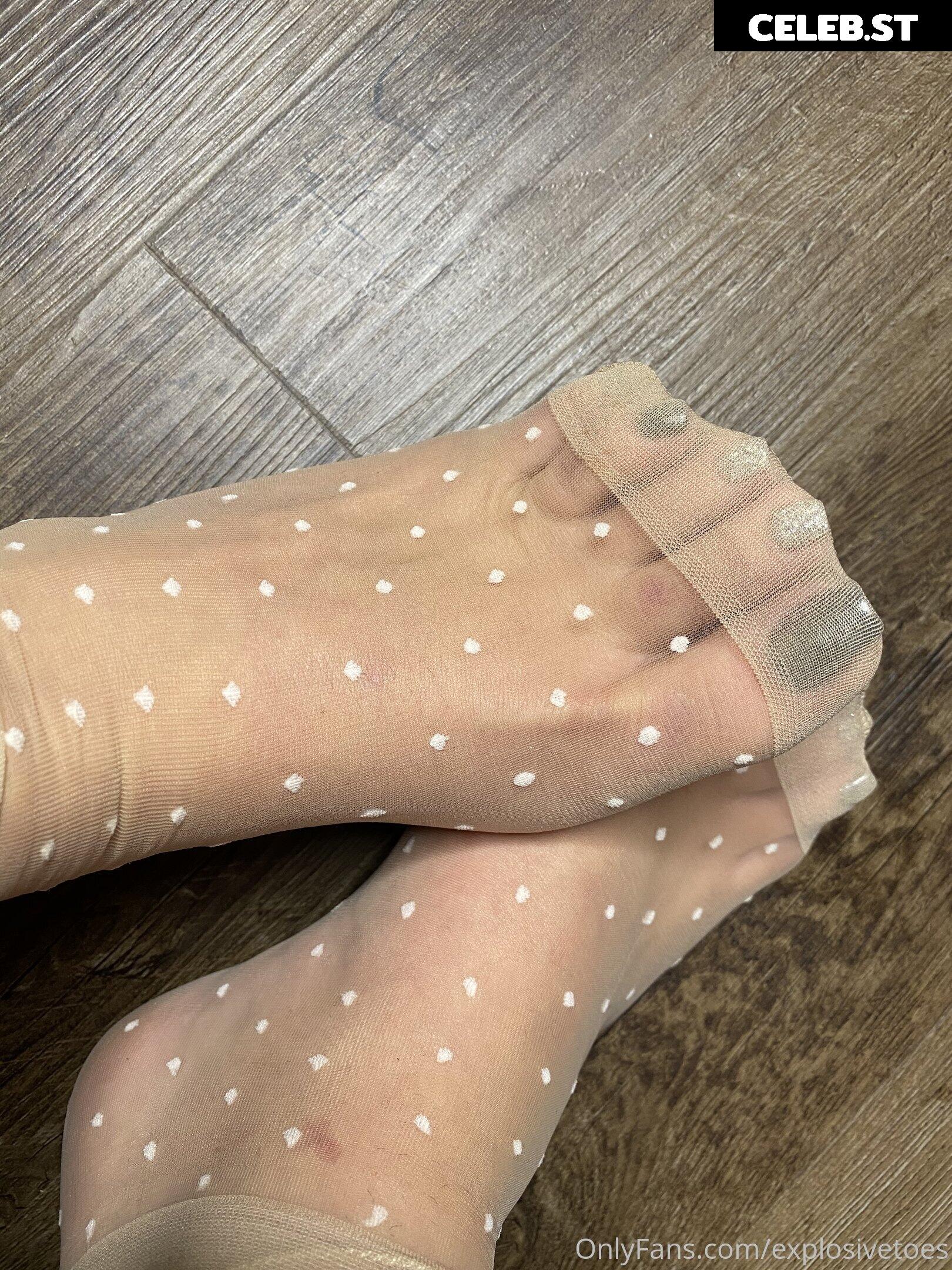 explosivetoess Image 17773204