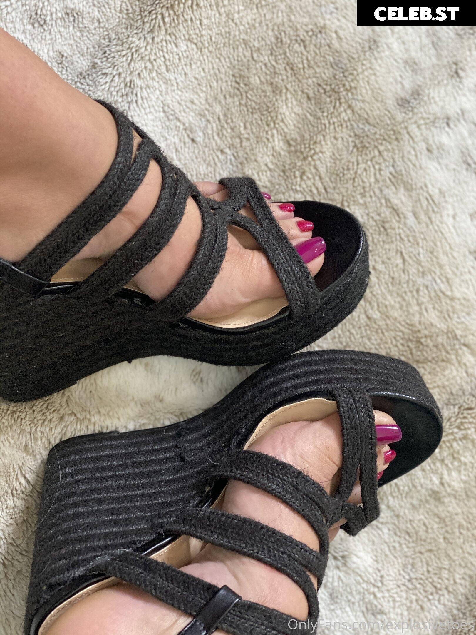 explosivetoess Image 17772900