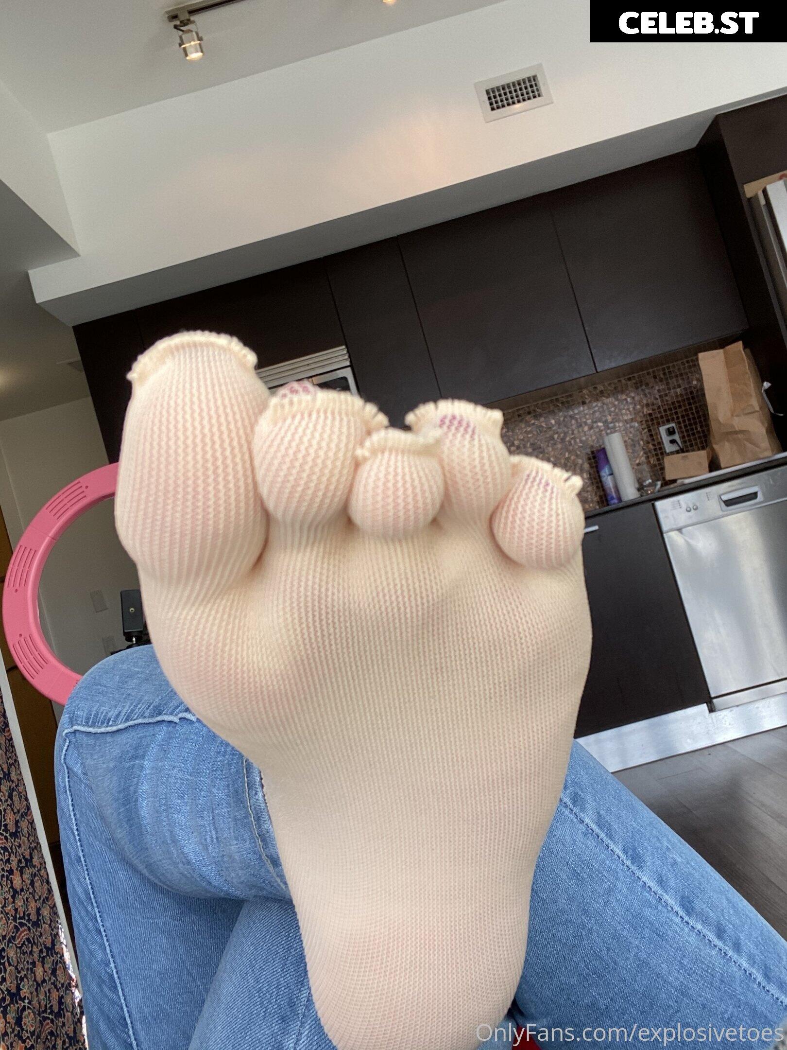 explosivetoess Image 17772893