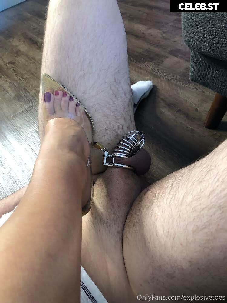 explosivetoess Image 17772835