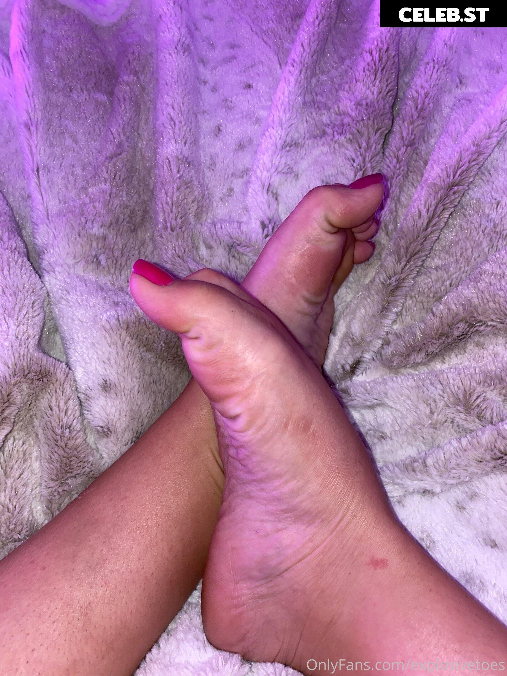 explosivetoess Image 17772842