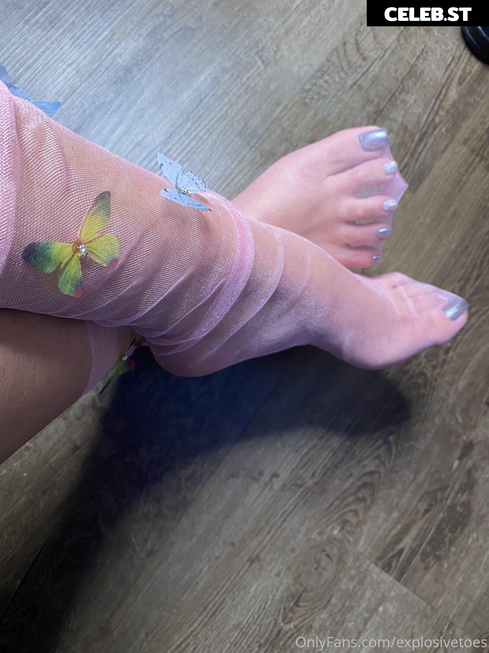 explosivetoess Image 17772593