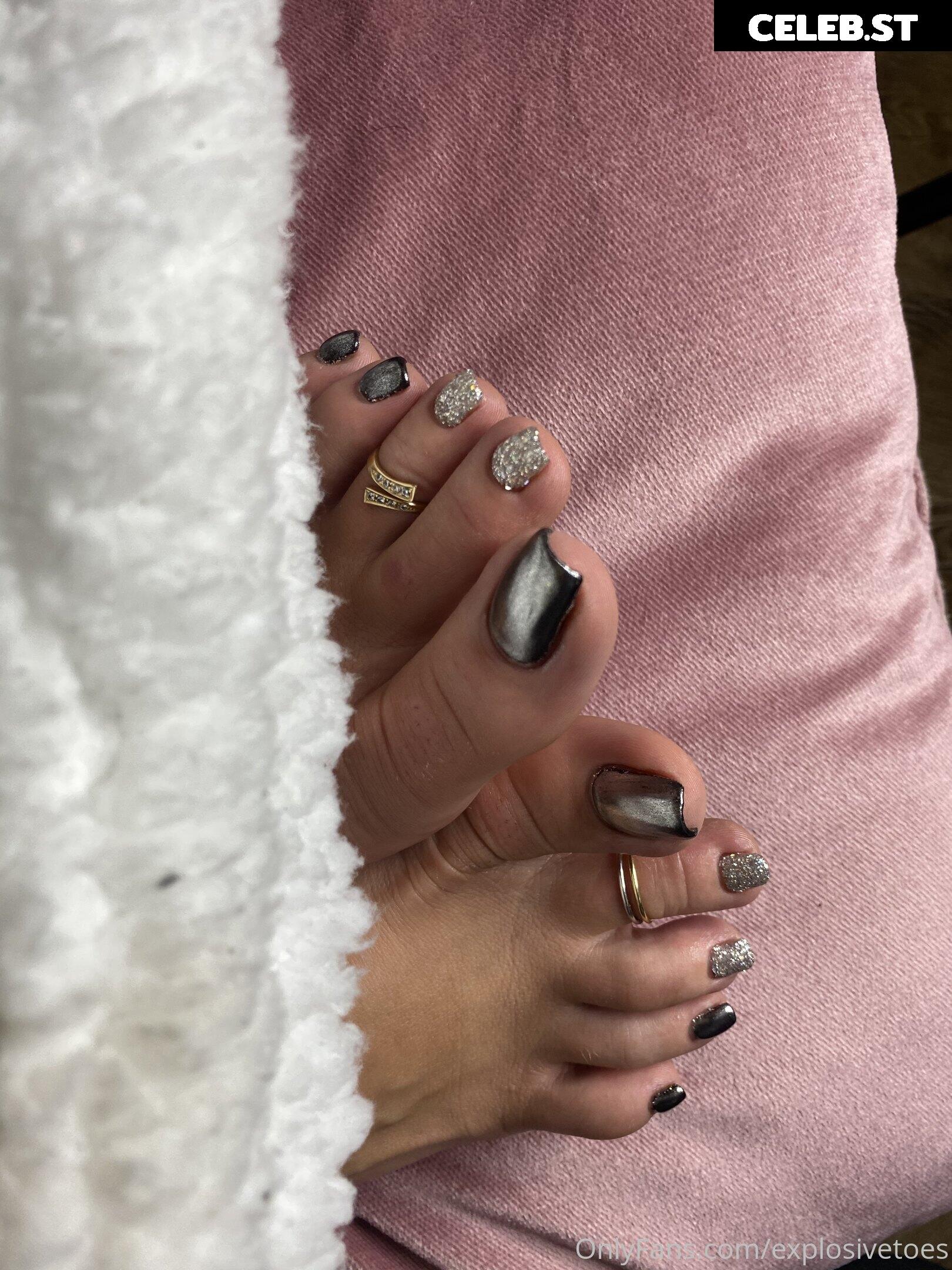 explosivetoess Image 17772562