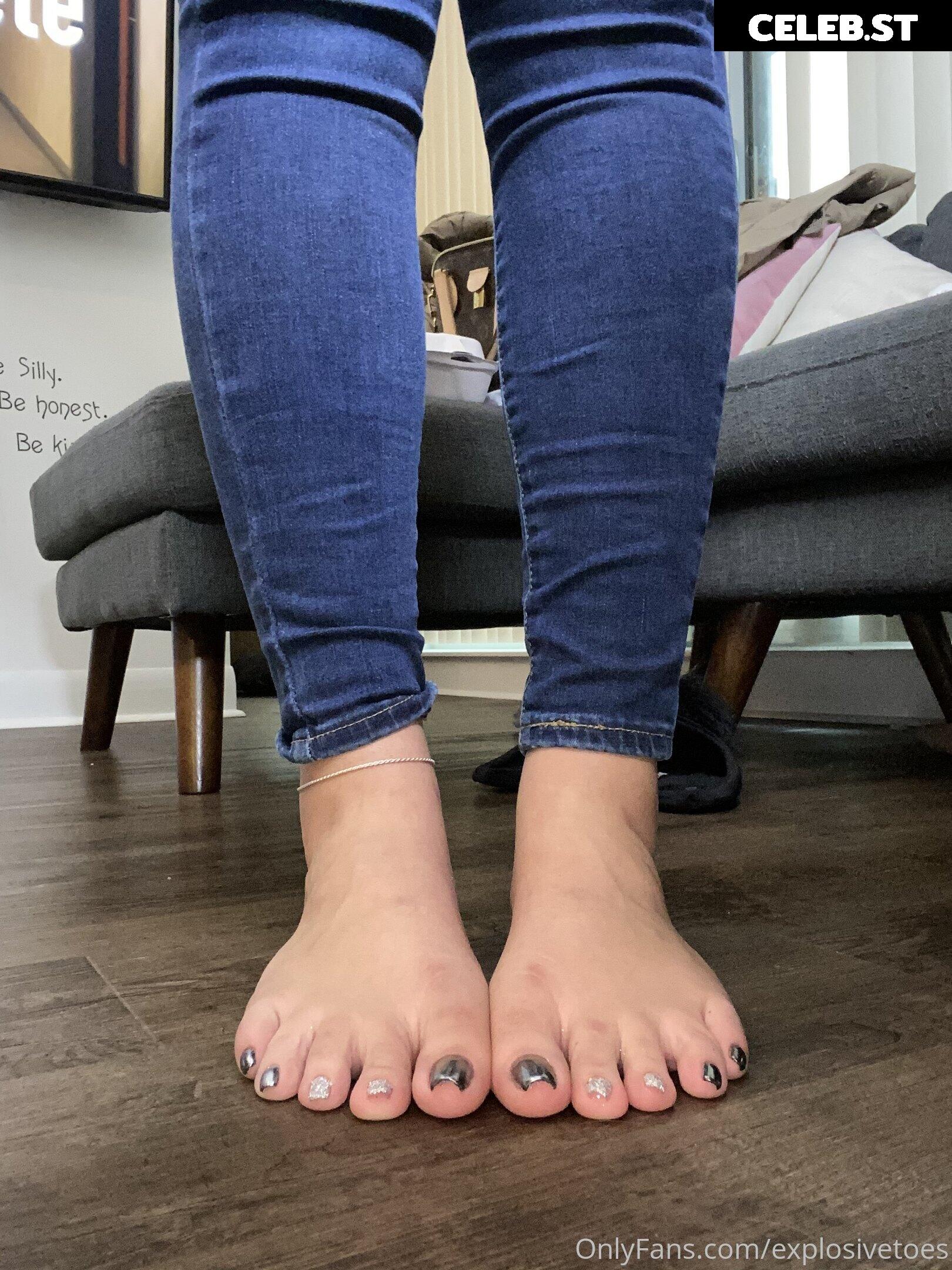 explosivetoess Image 17772736