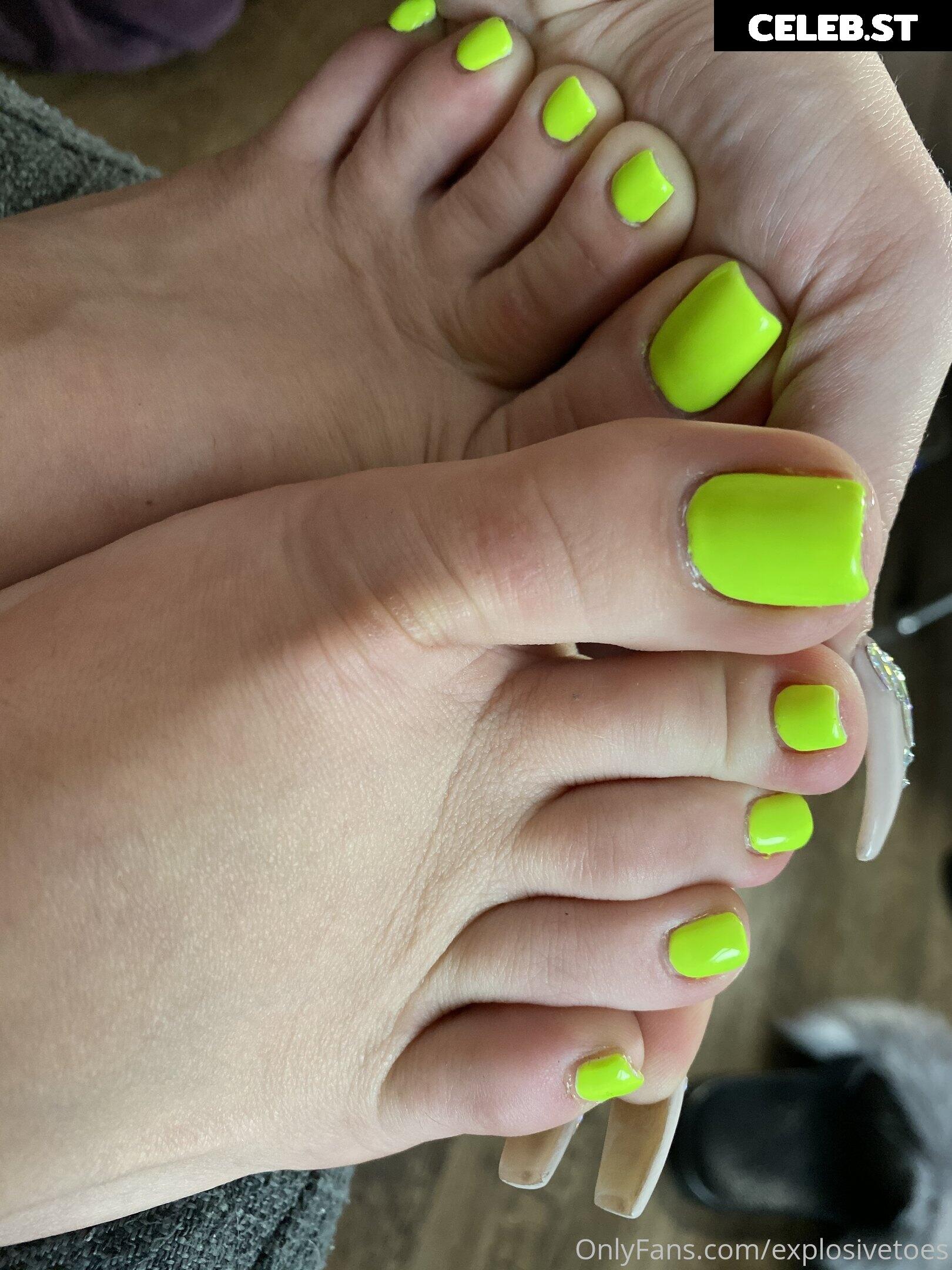 explosivetoess Image 17779343