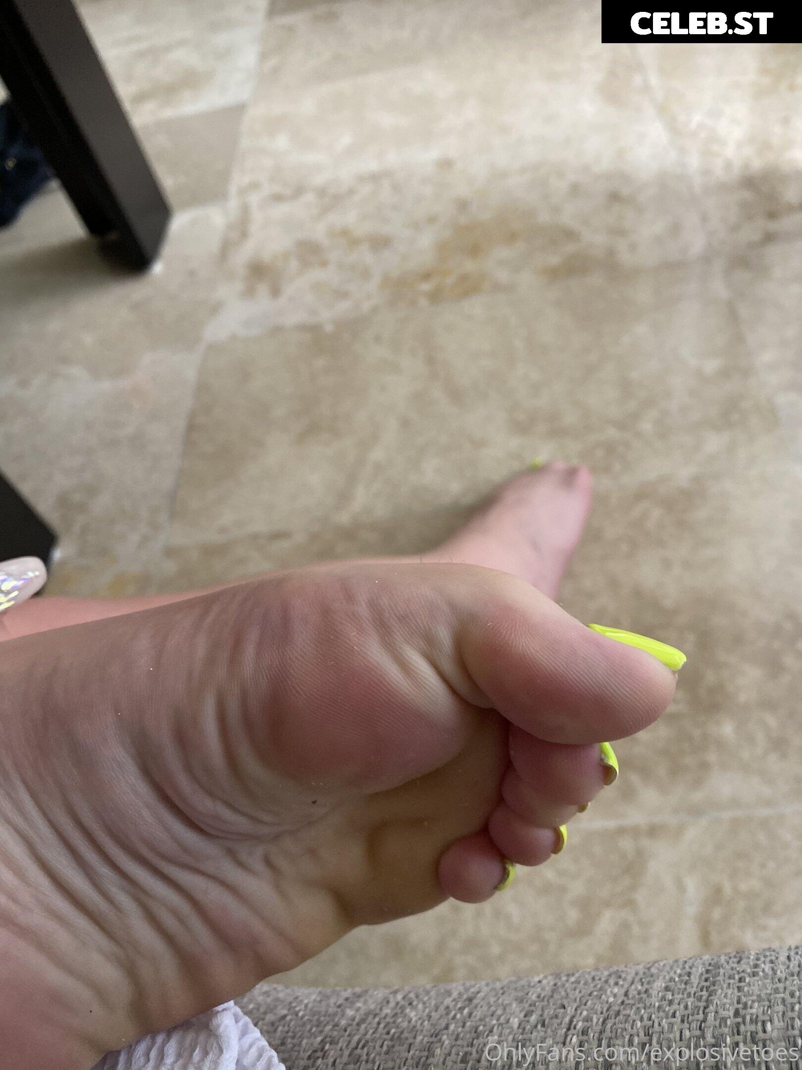 explosivetoess Image 17779224
