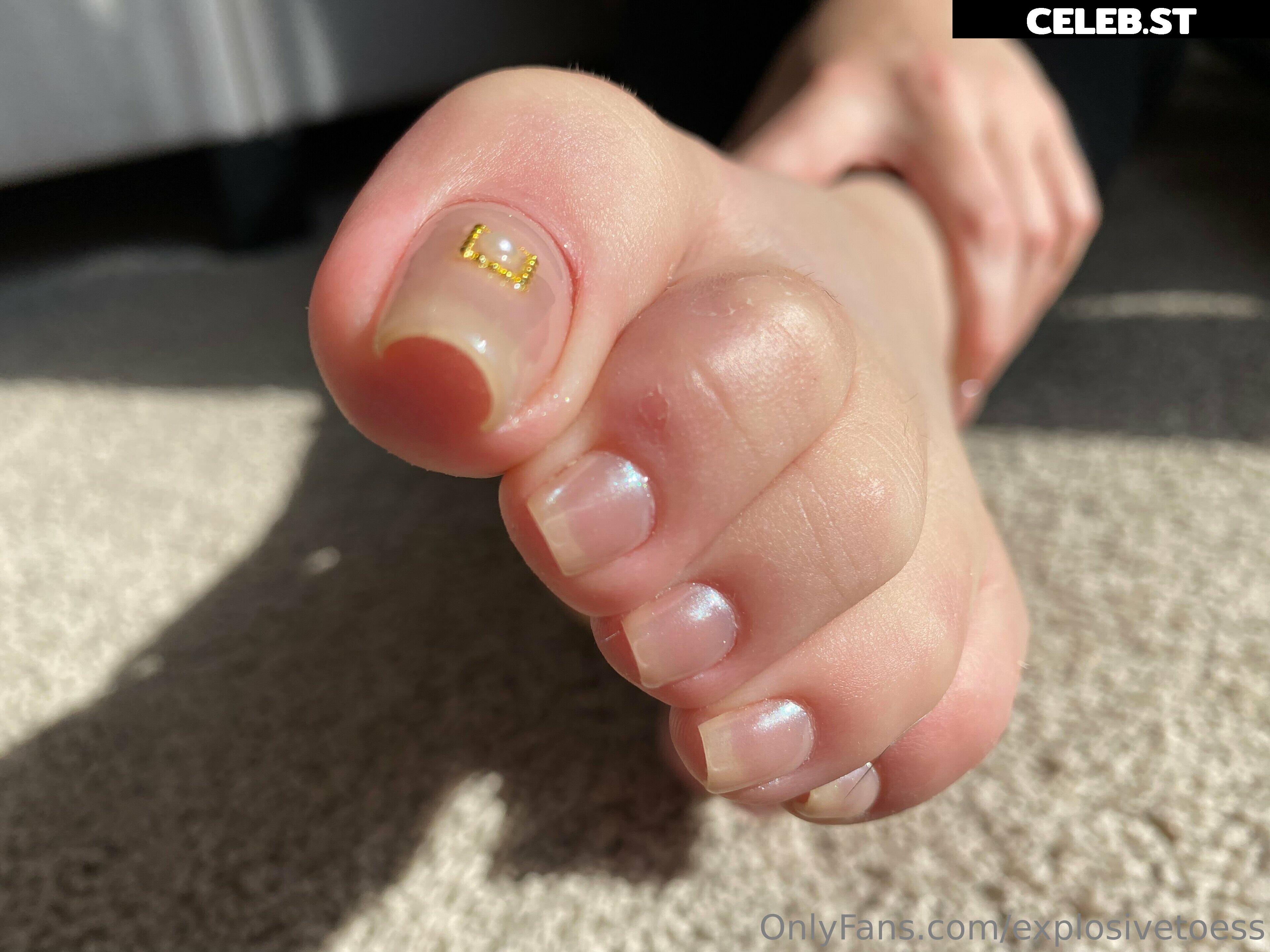 explosivetoess Image 17718421