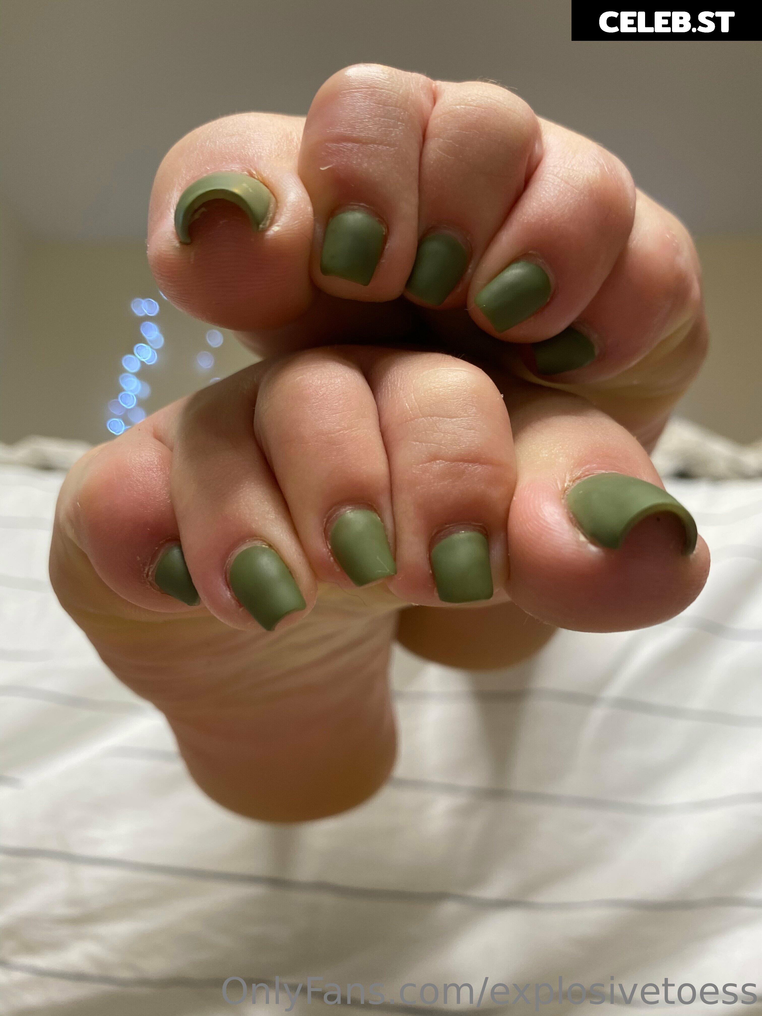 explosivetoess Image 17718624