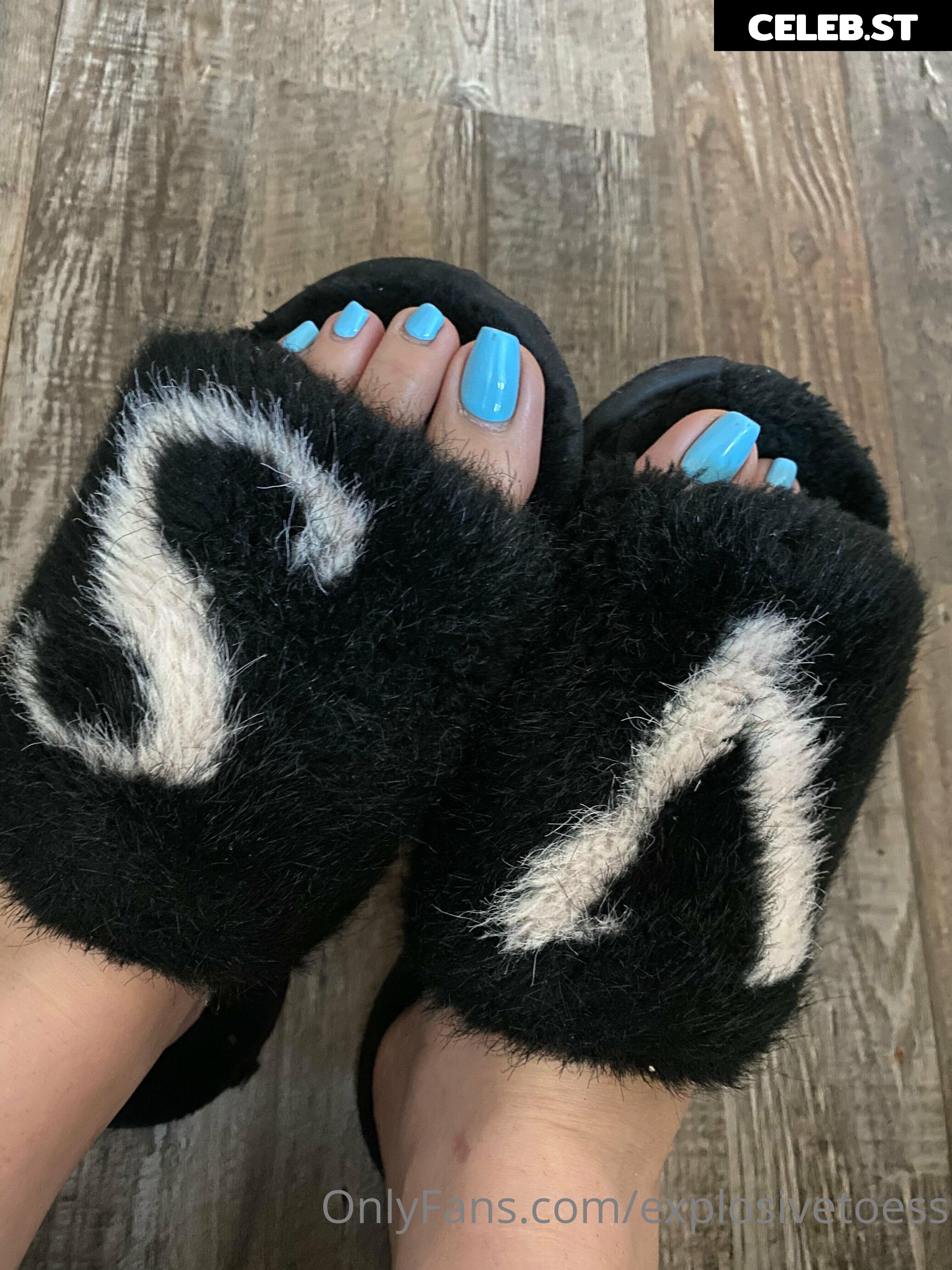 explosivetoess Image 17718653