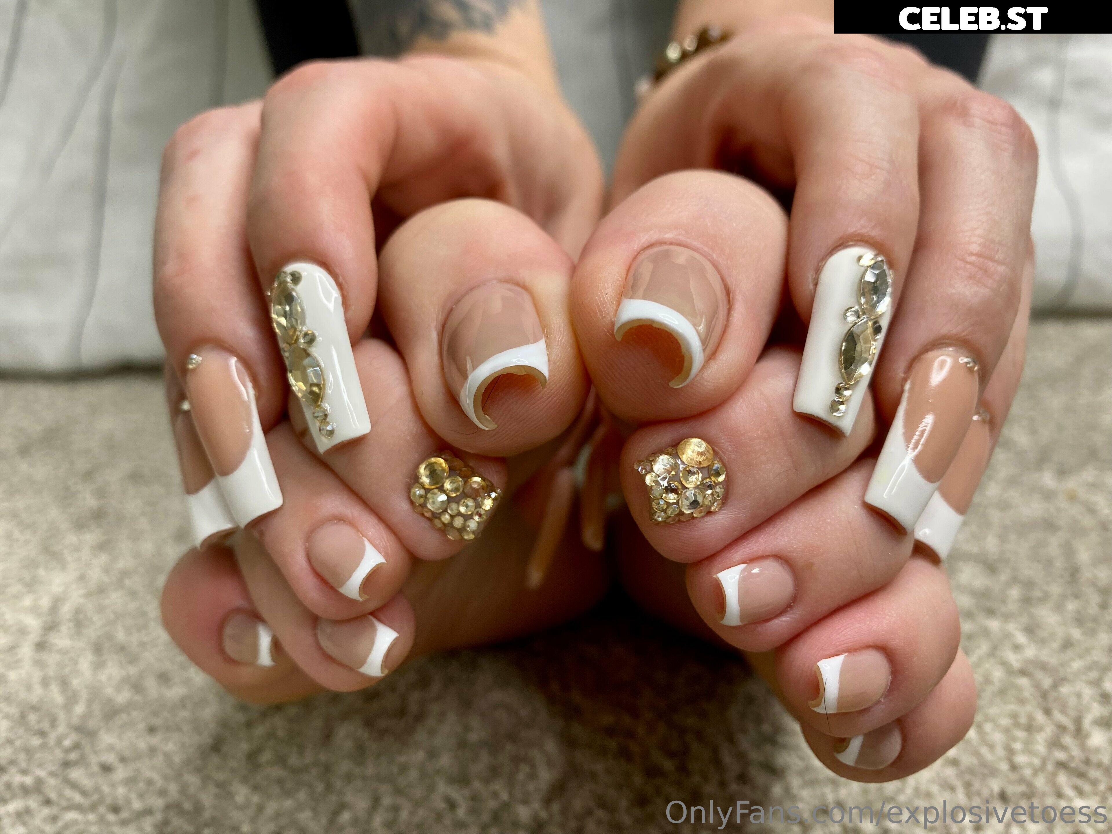 explosivetoess Image 17715922