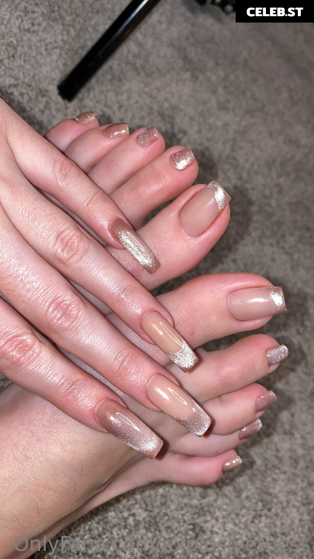 explosivetoess Image 17715845