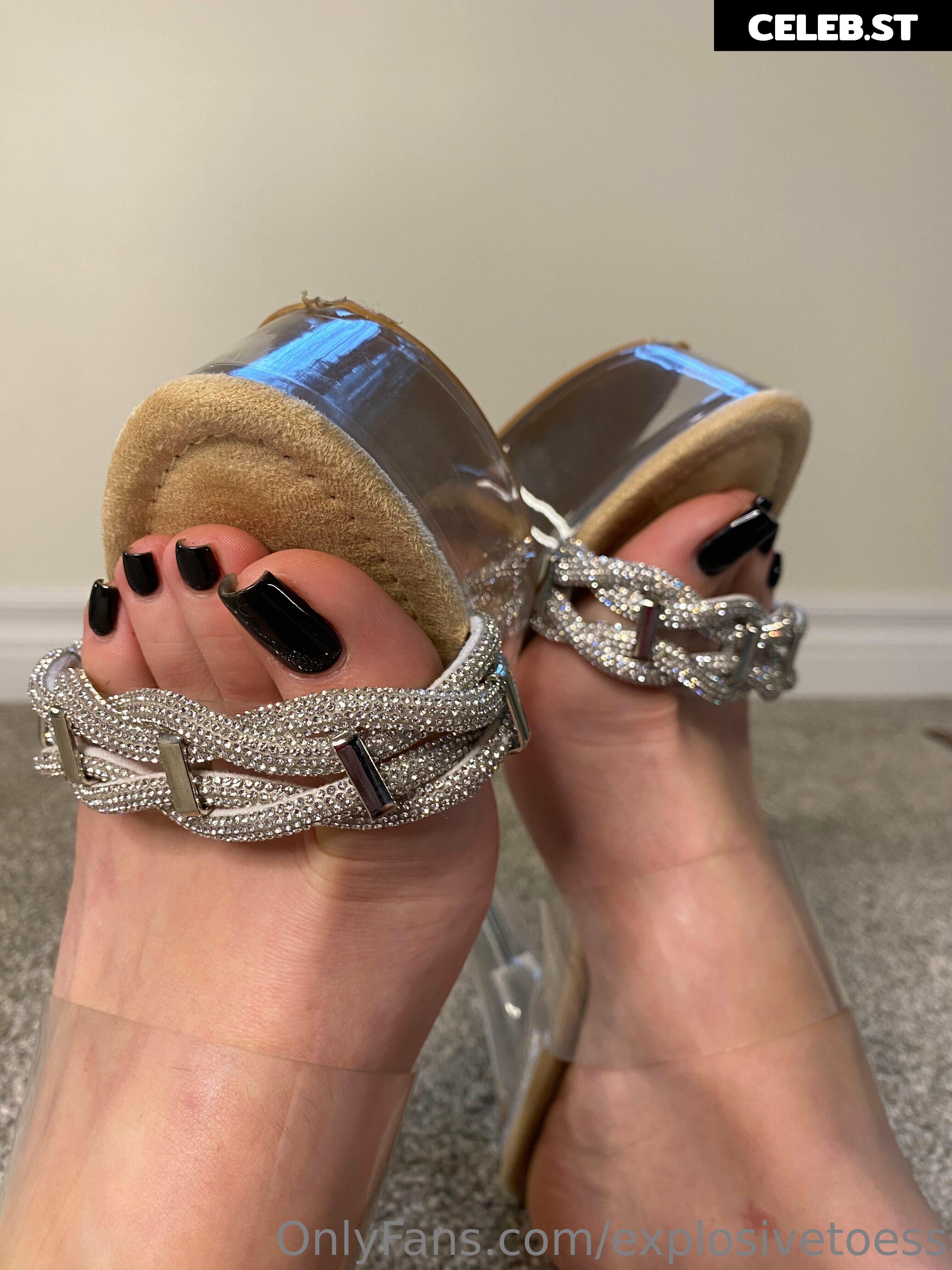 explosivetoess Image 17715414