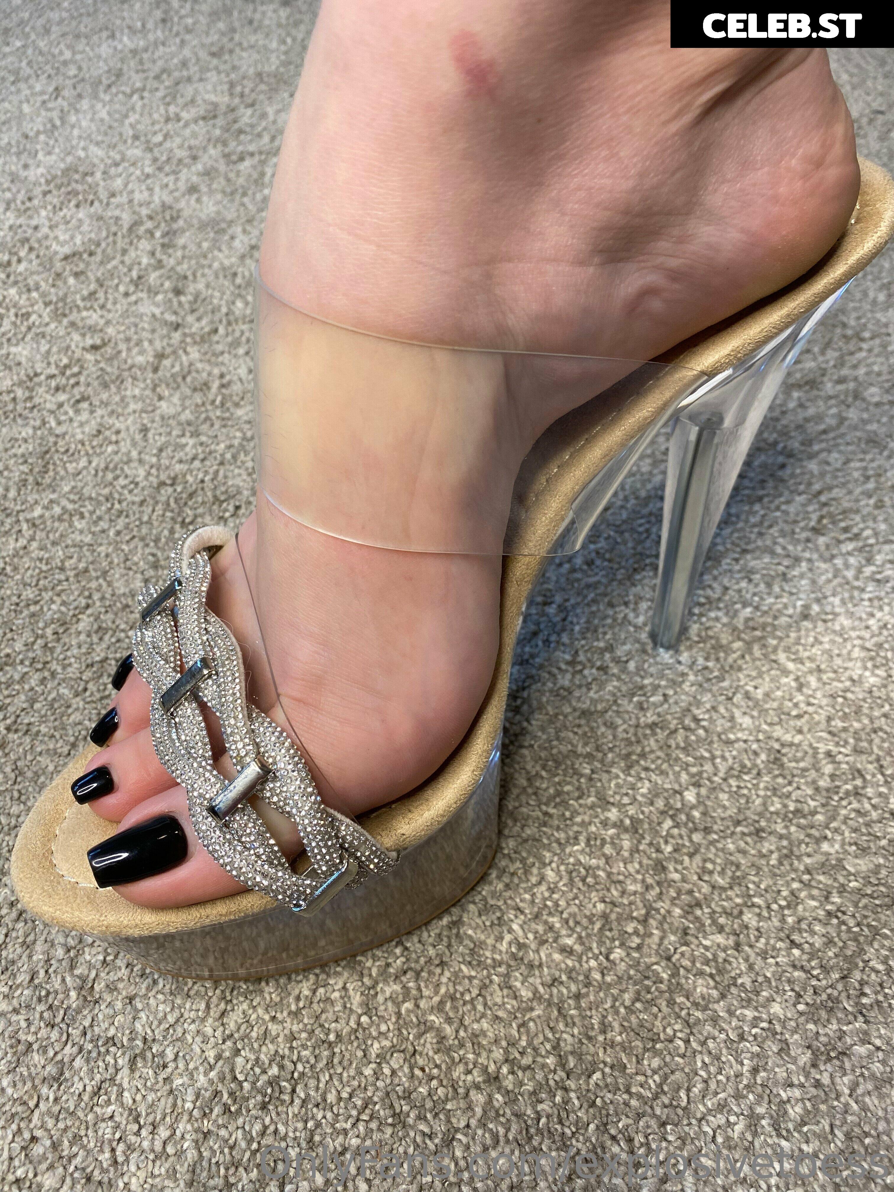 explosivetoess Image 17715722