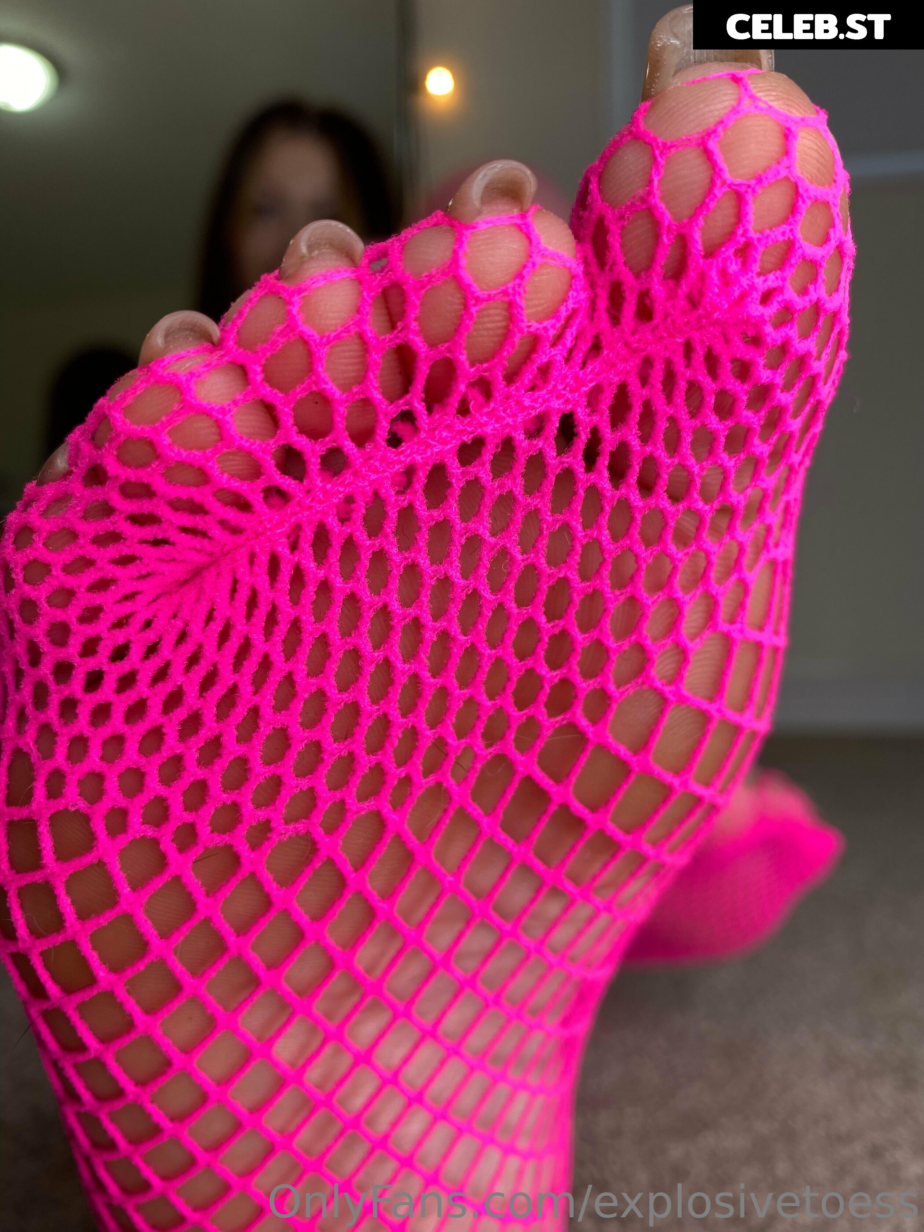 explosivetoess Image 17715133
