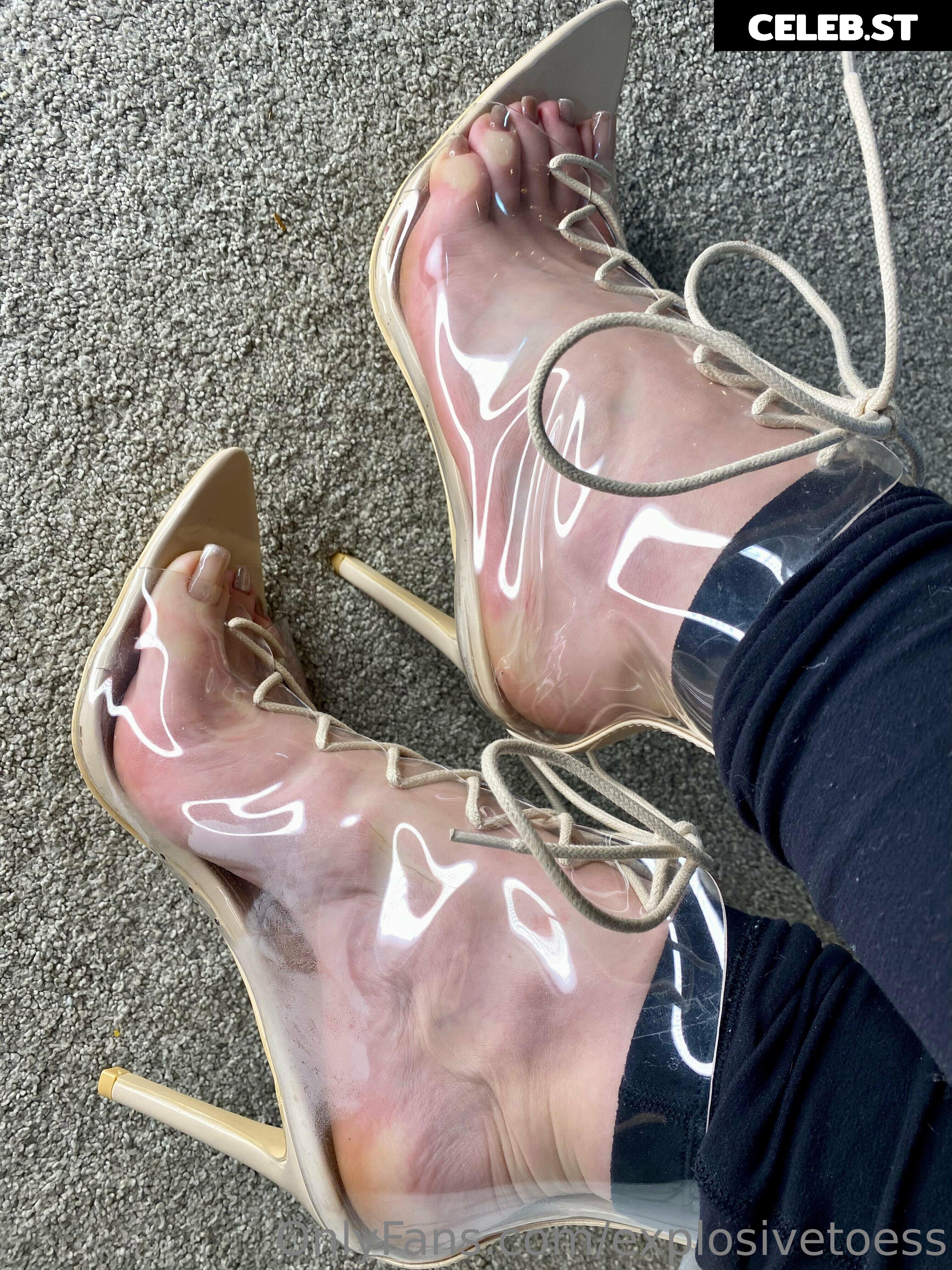 explosivetoess Image 17715282