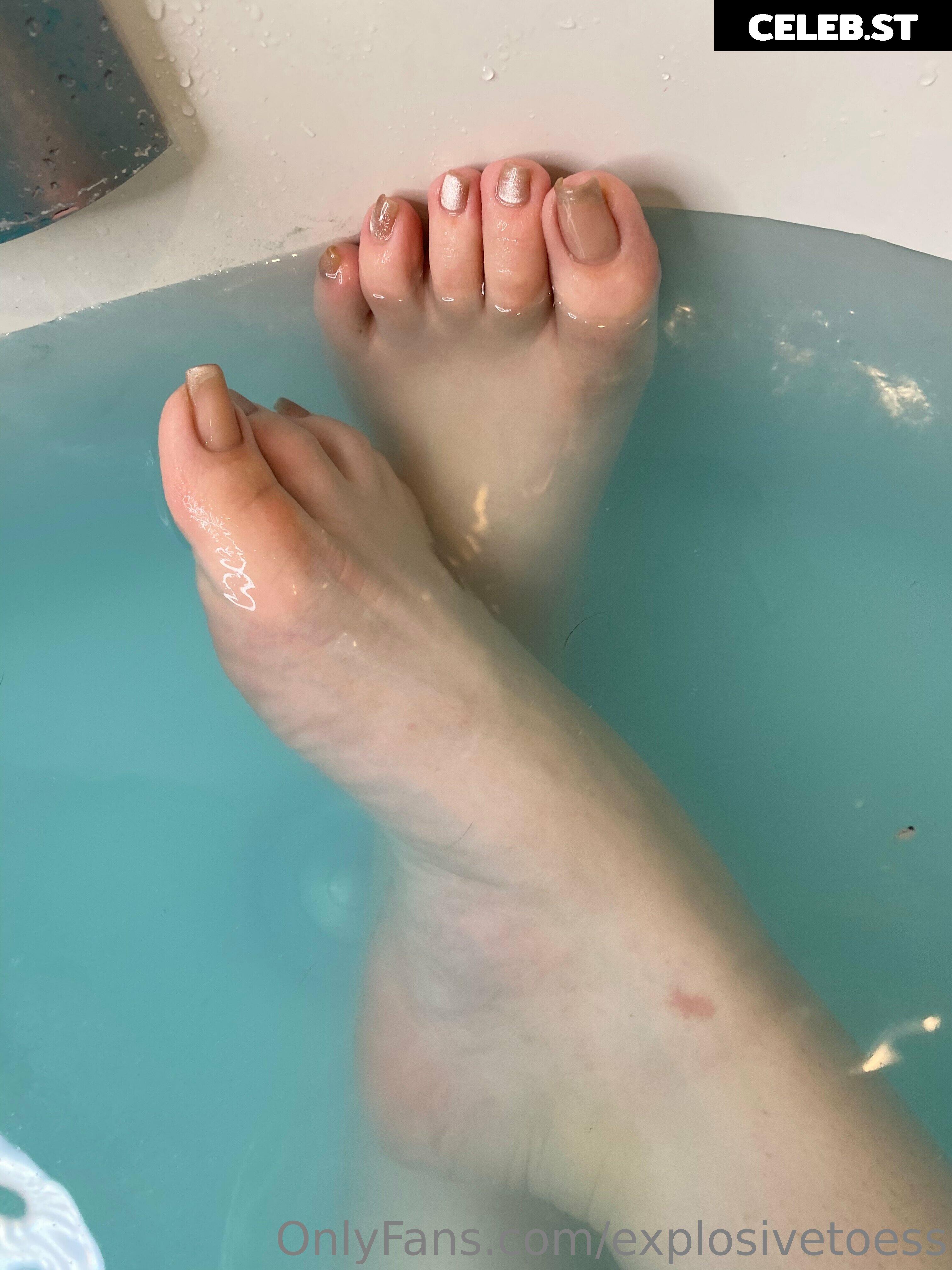 explosivetoess Image 17715251