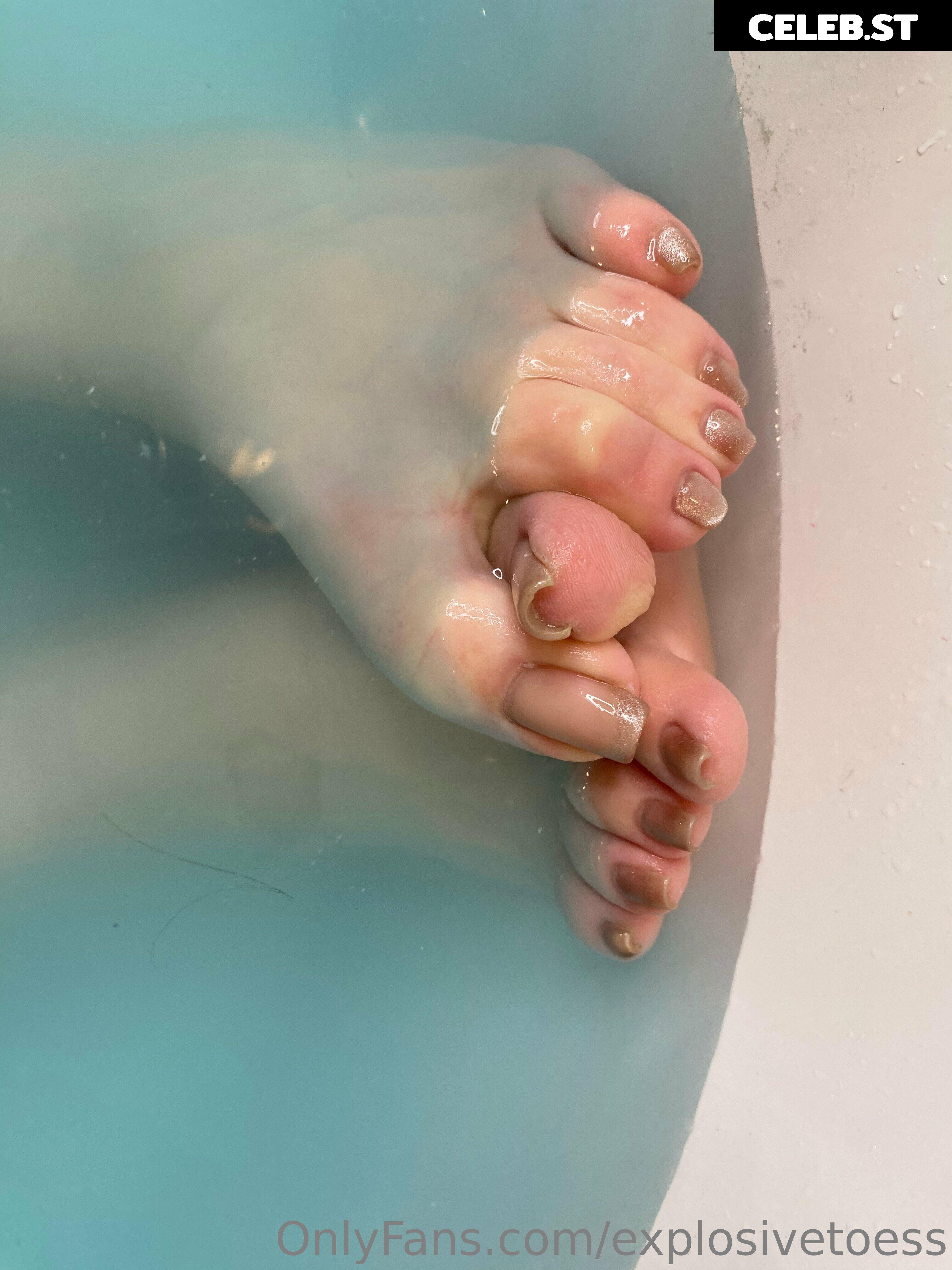 explosivetoess Image 17714926