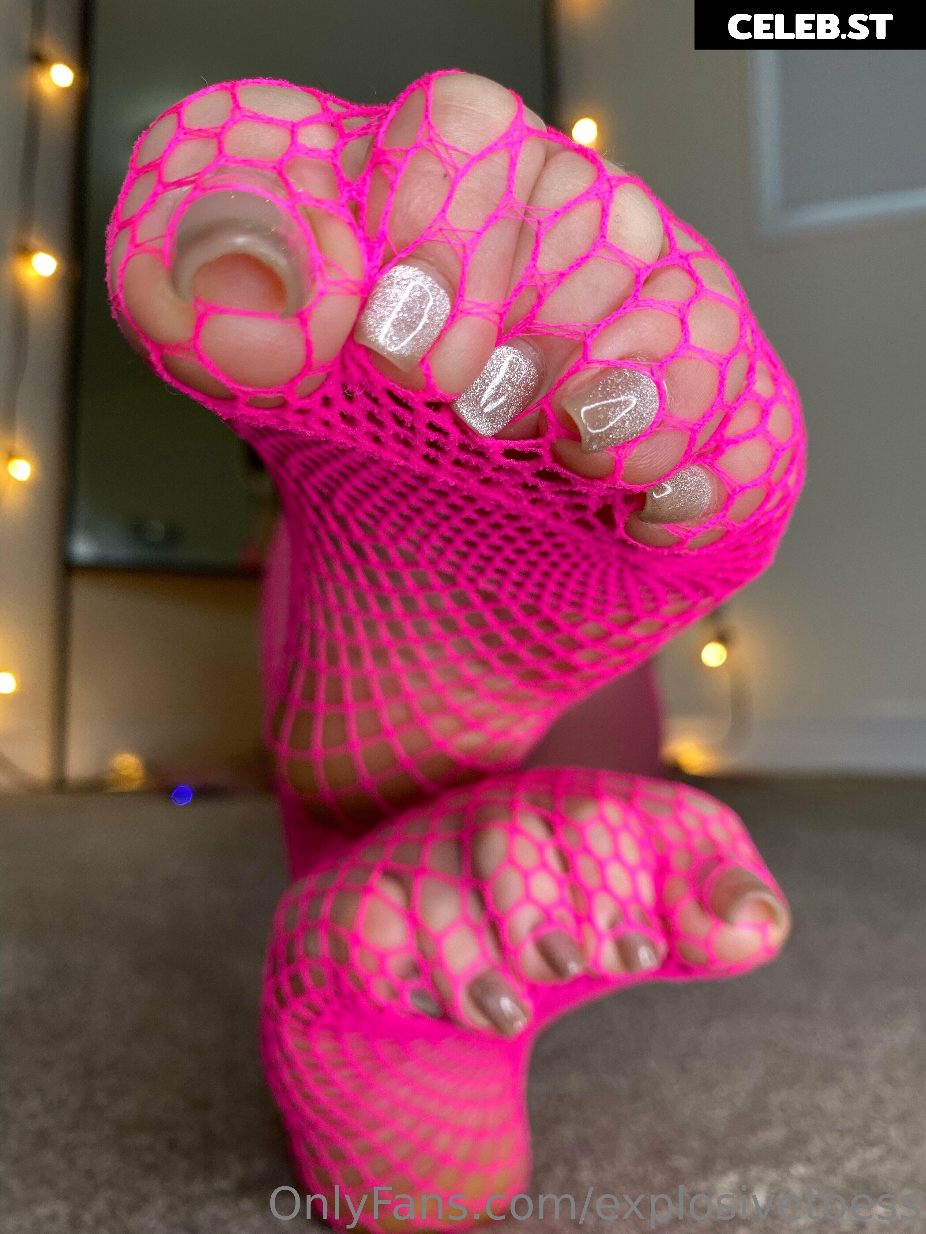 explosivetoess Image 17714863
