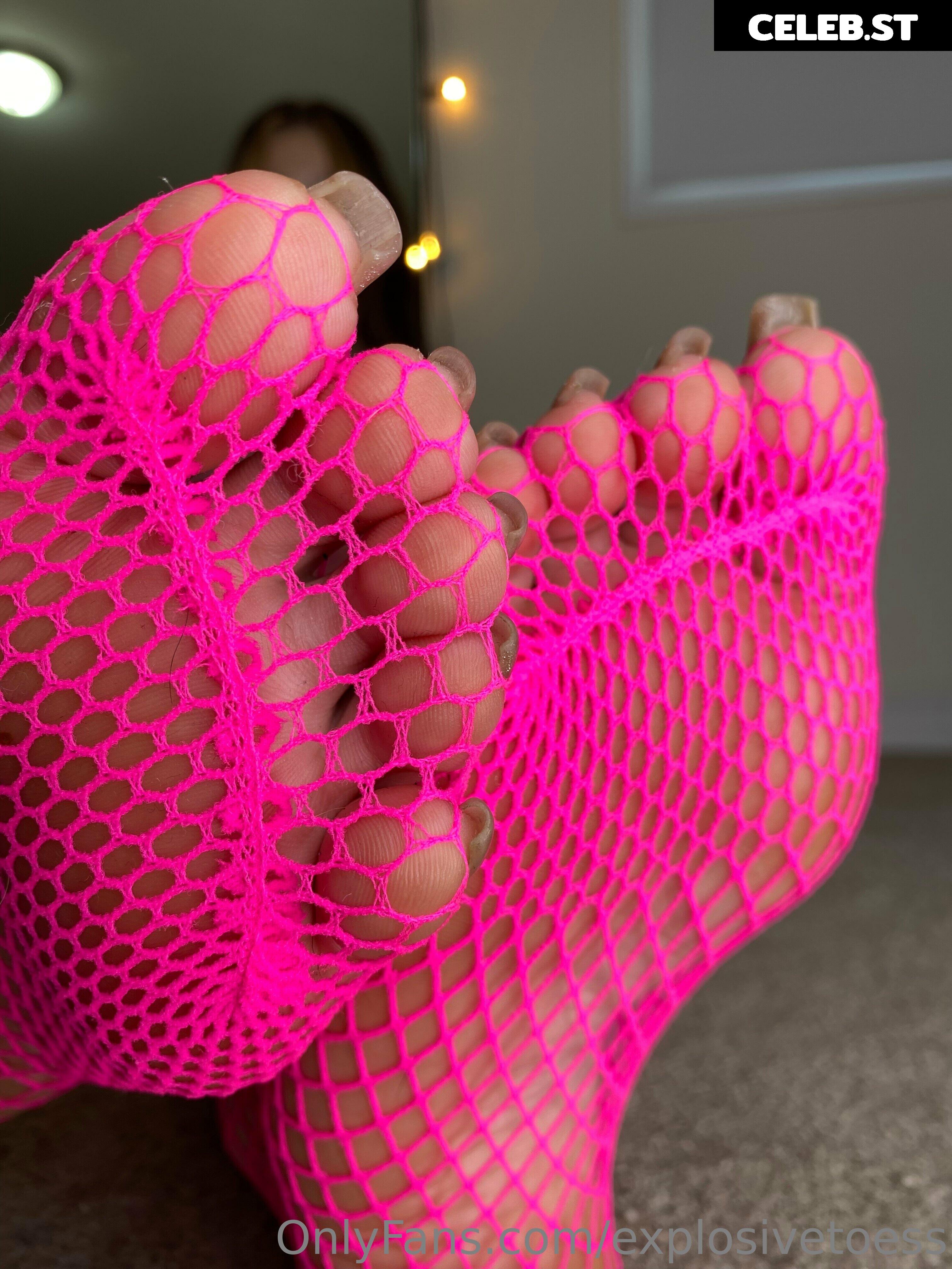 explosivetoess Image 17714860