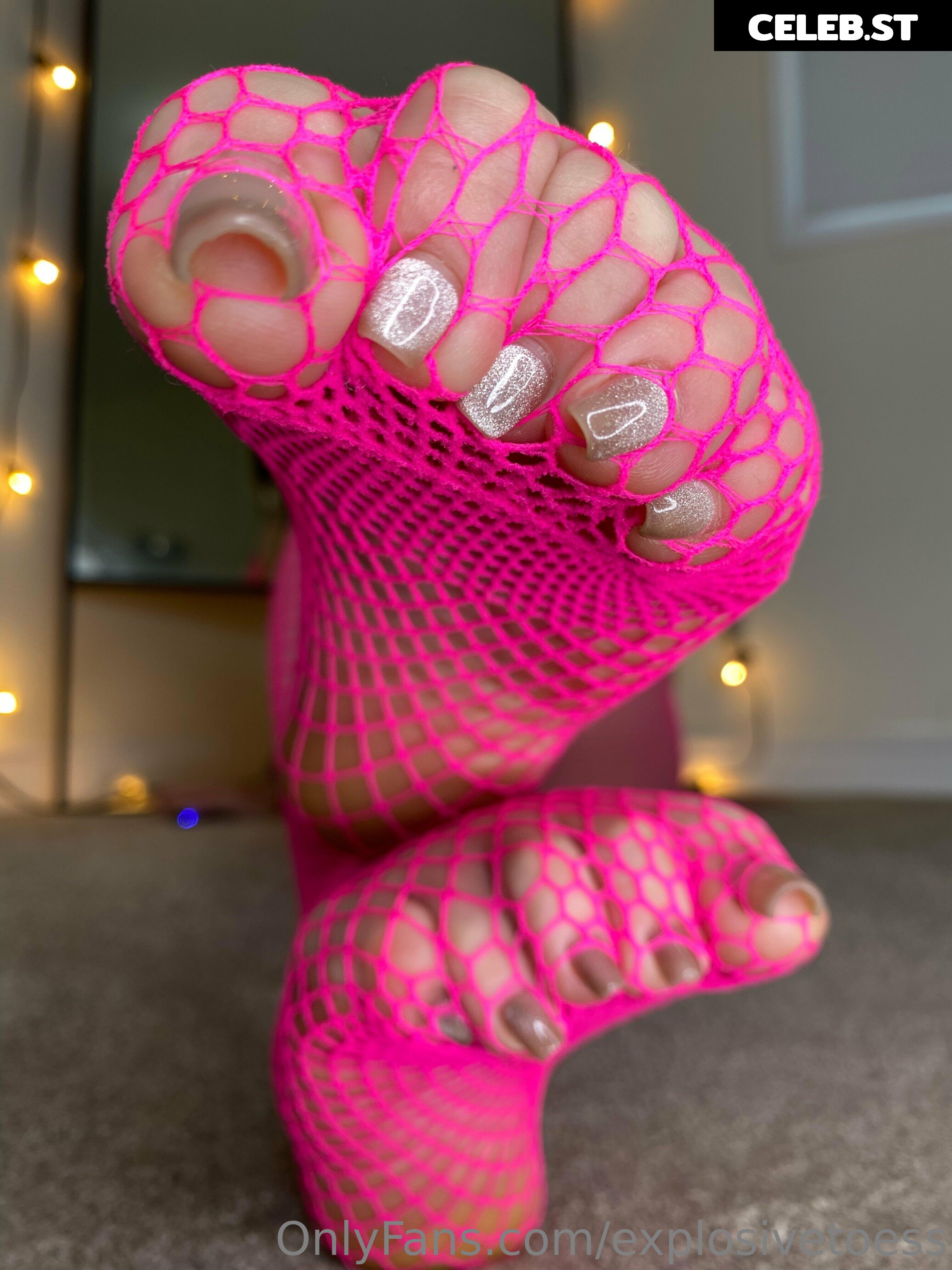 explosivetoess Image 17714867