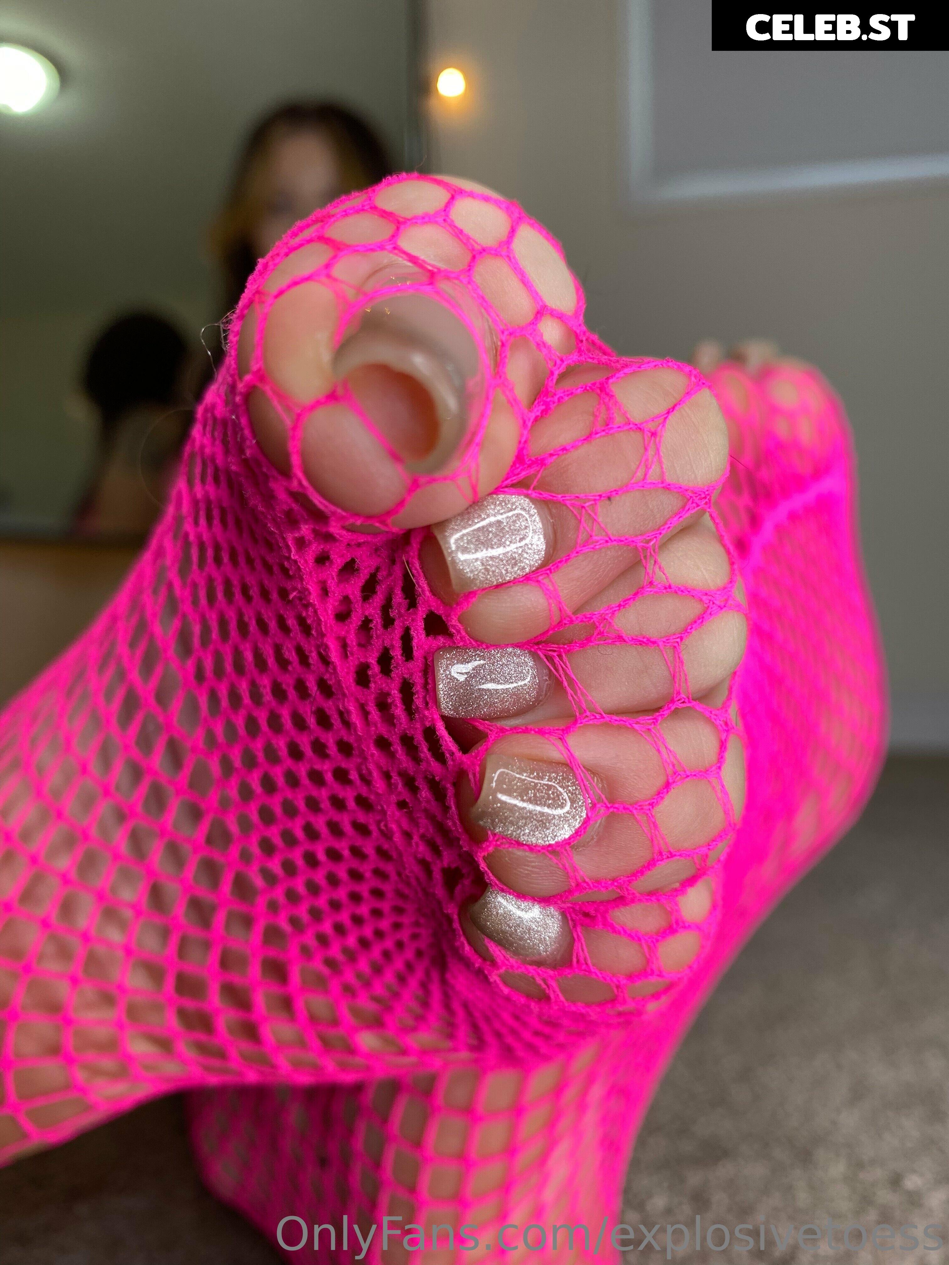 explosivetoess Image 17714865