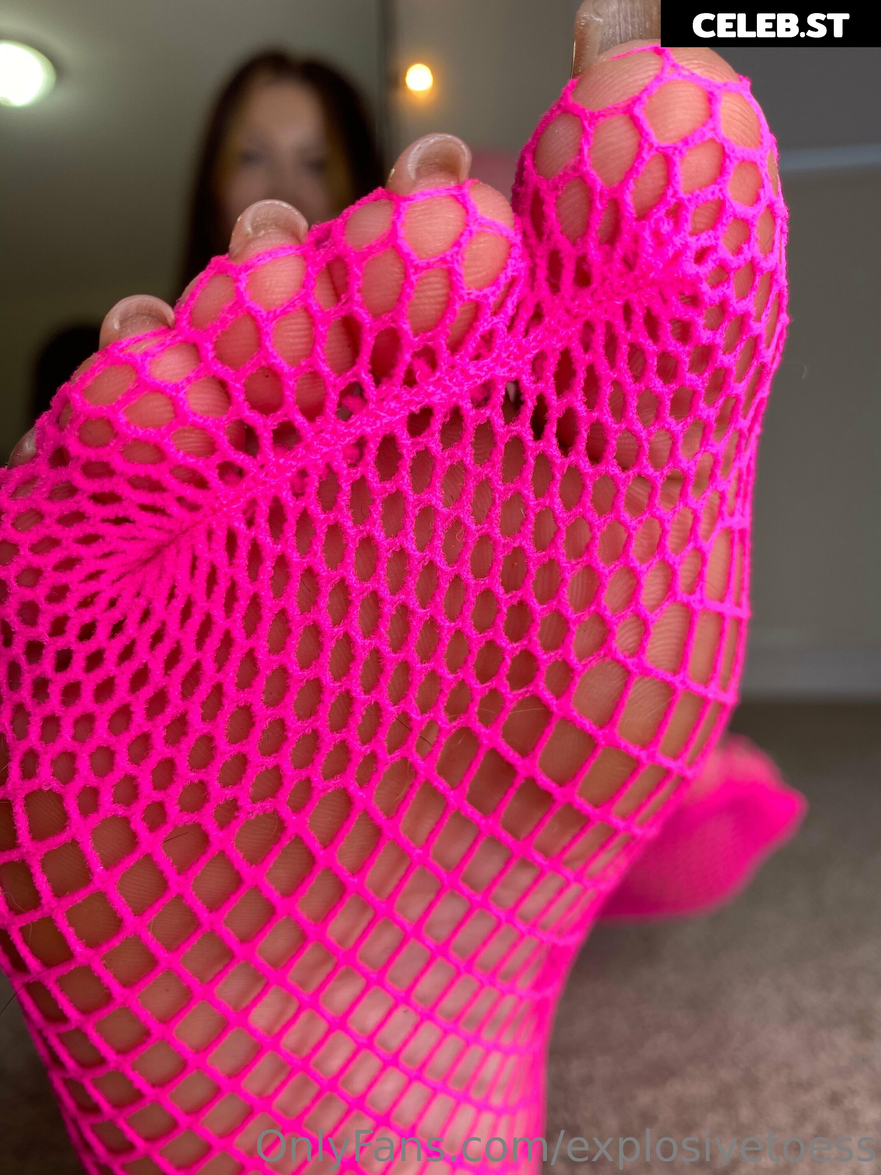explosivetoess Image 17714858