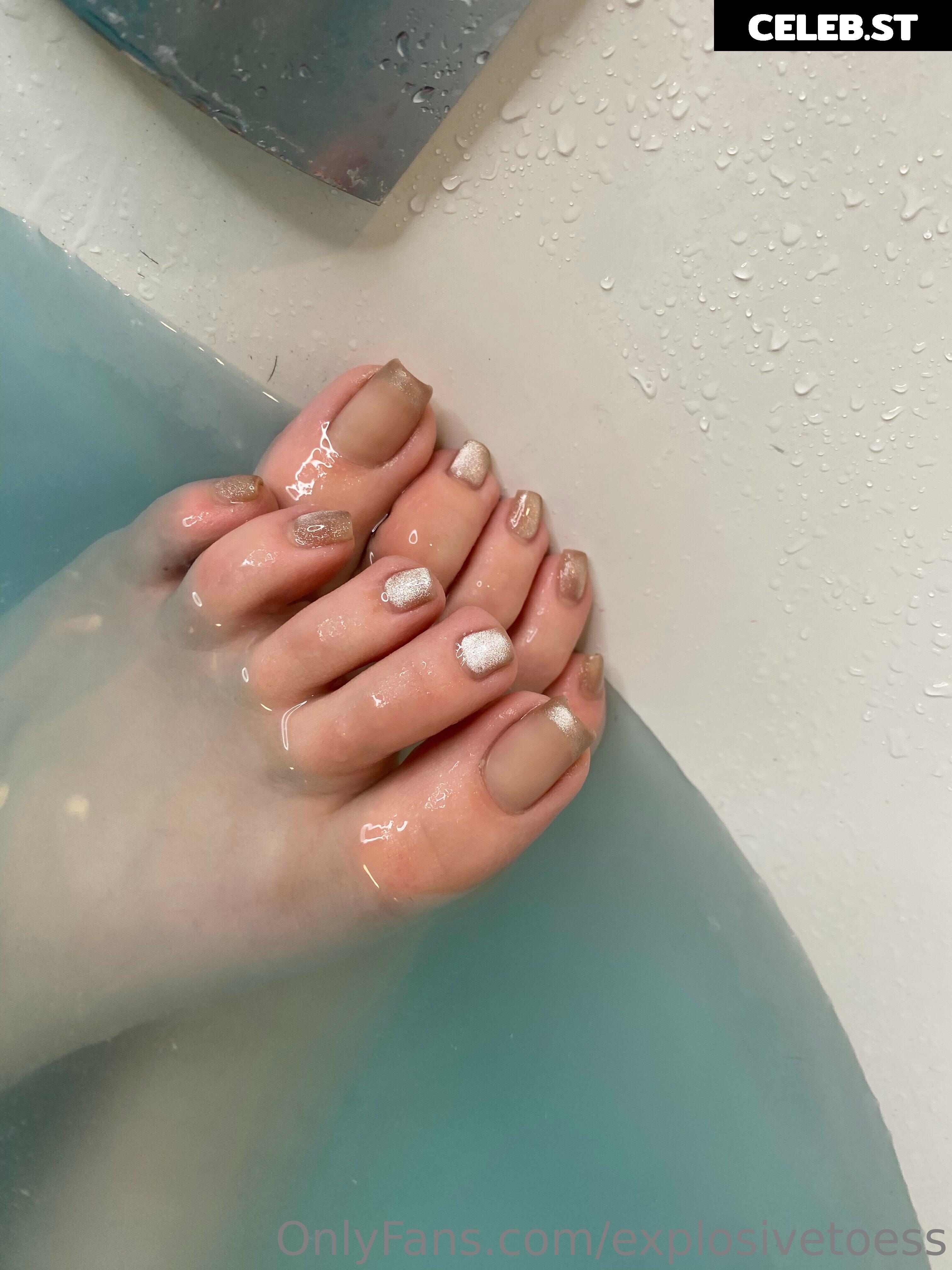 explosivetoess Image 17714848