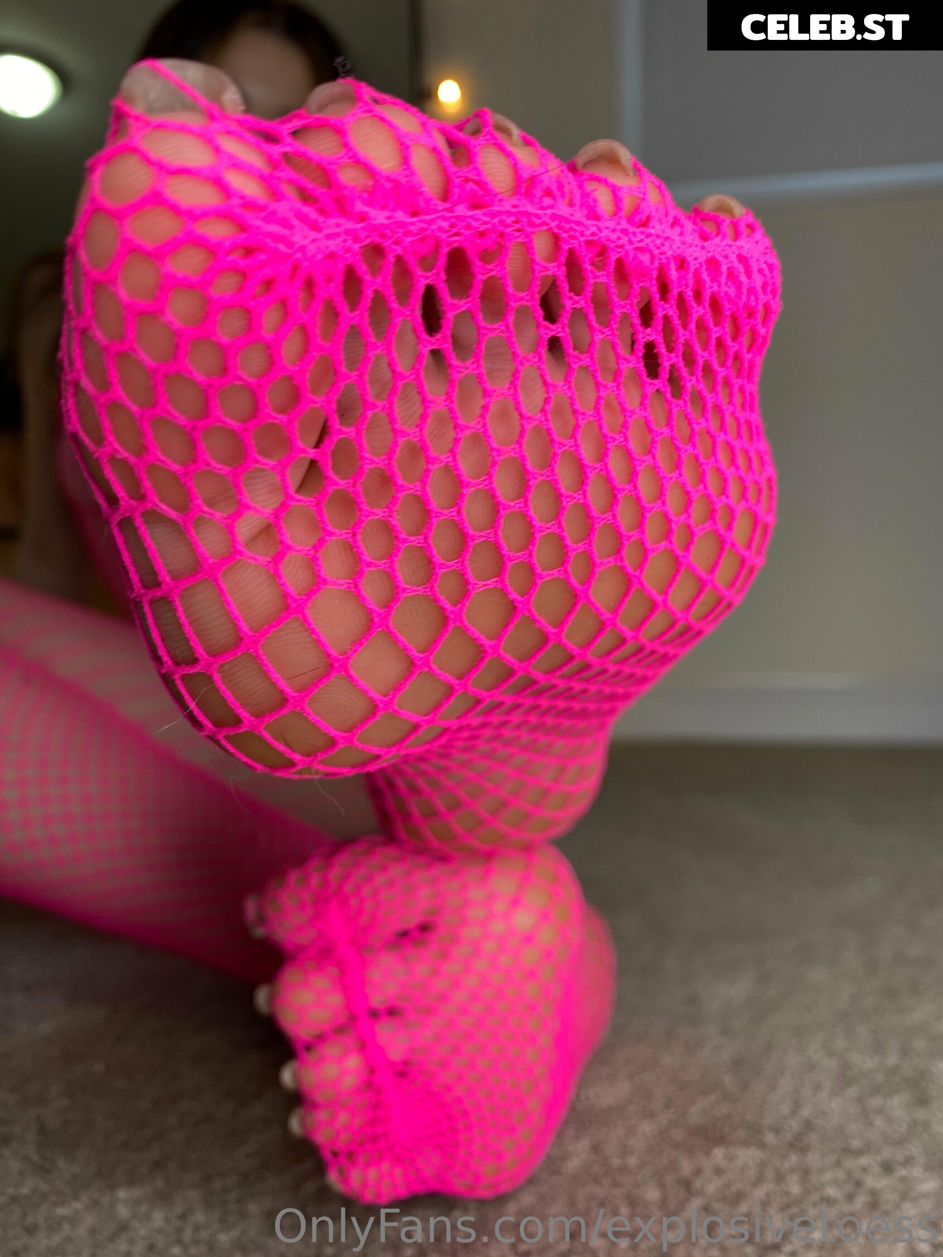 explosivetoess Image 17714875