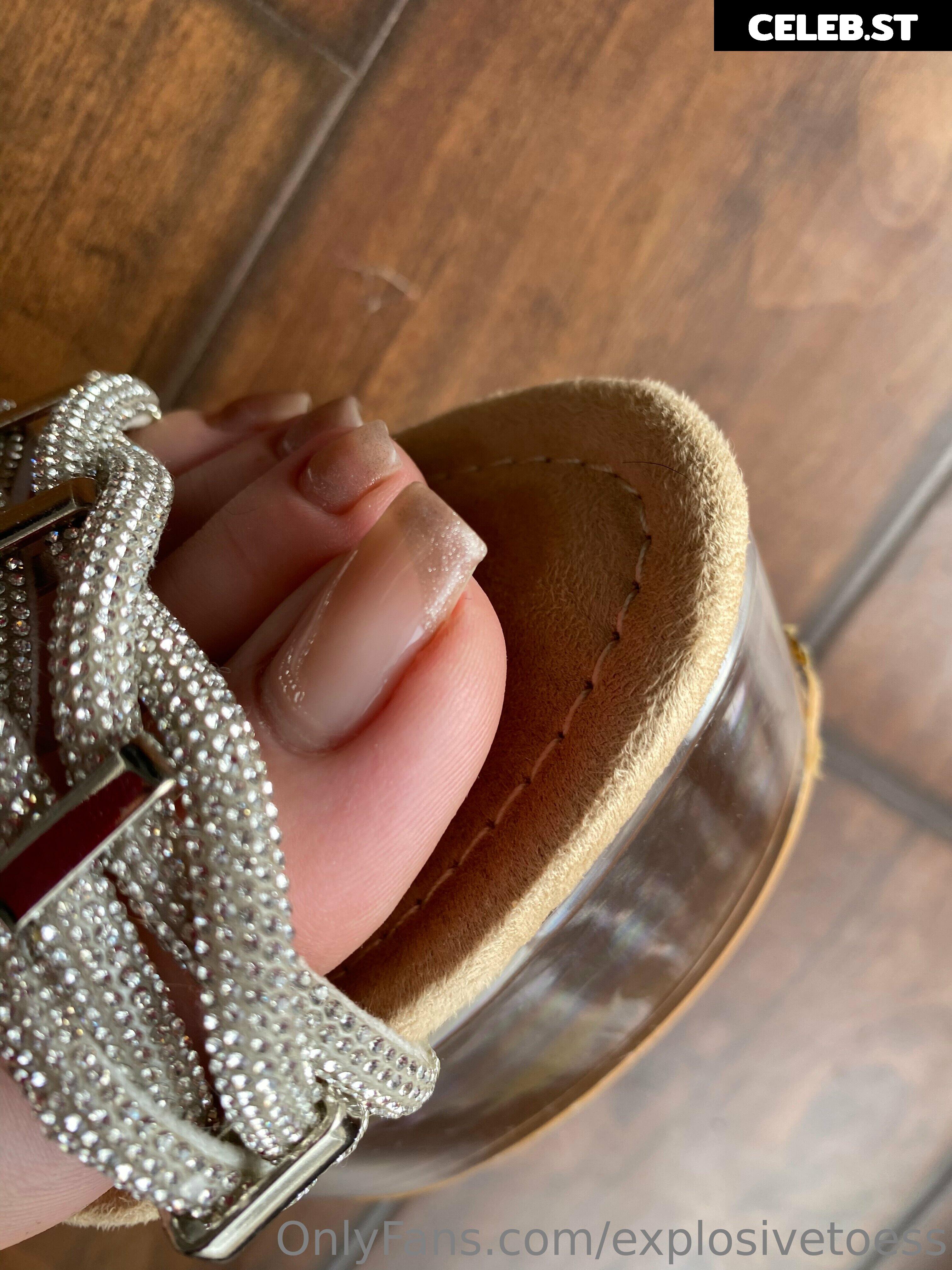 explosivetoess Image 17714765