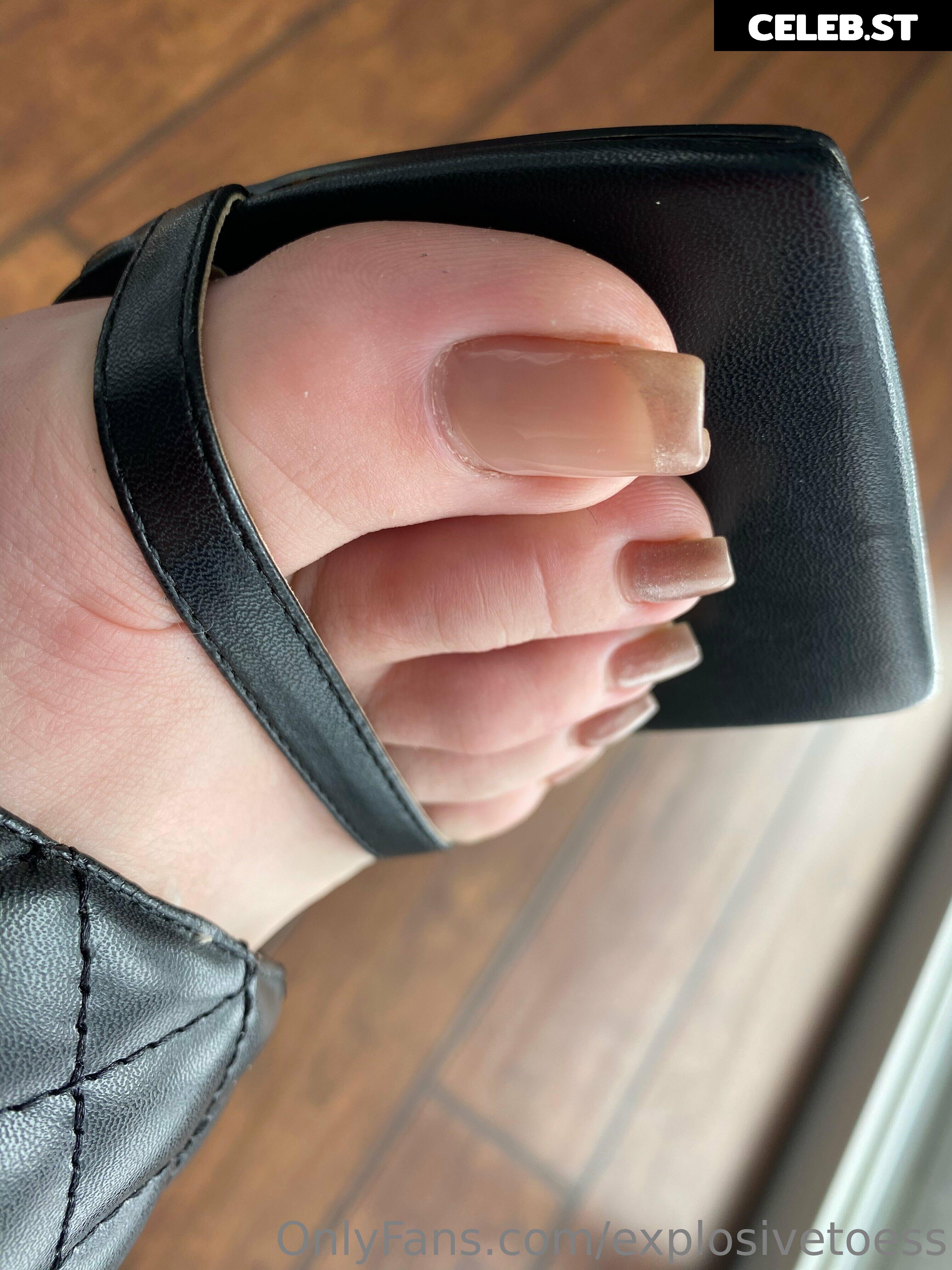 explosivetoess Image 17714769