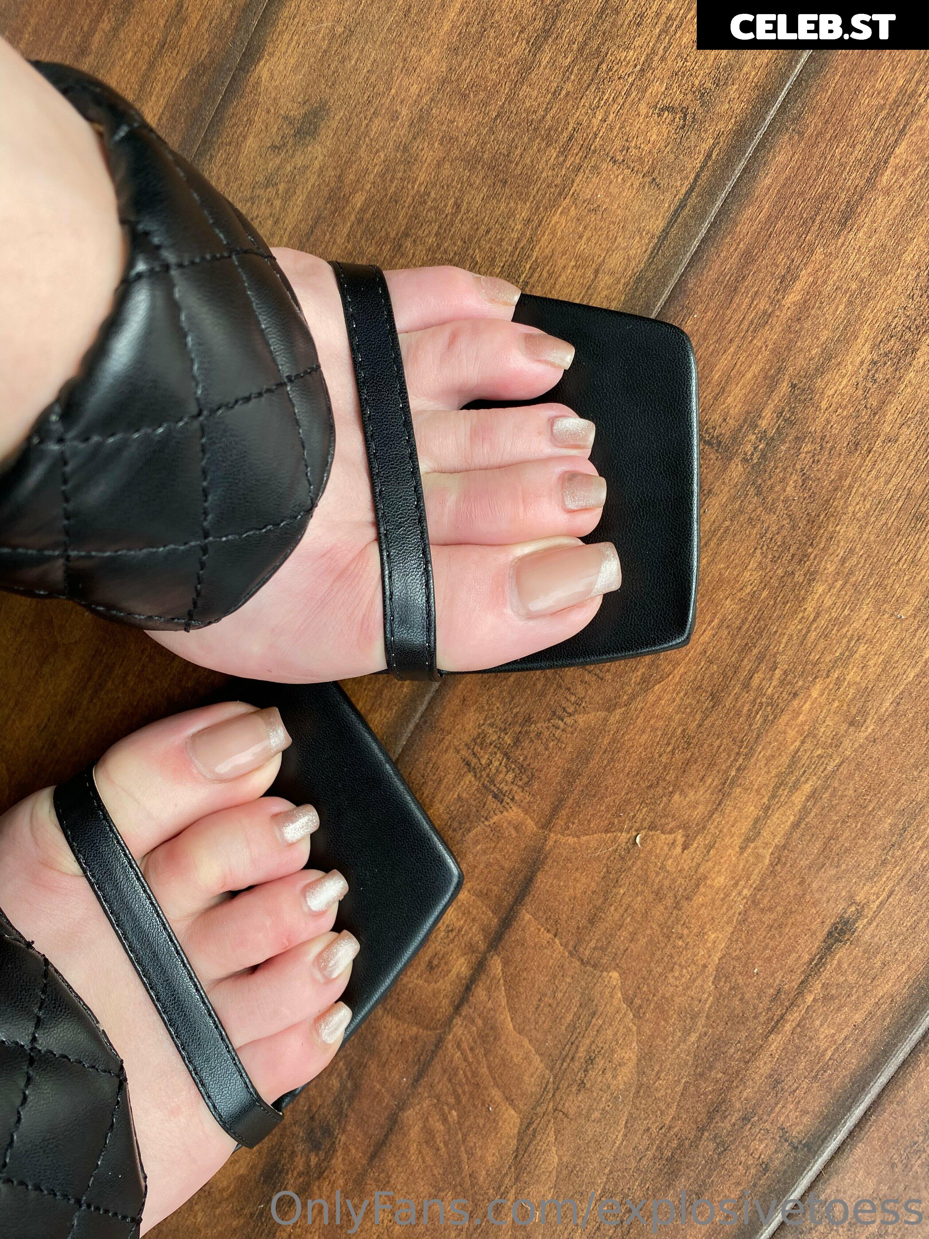explosivetoess Image 17714770