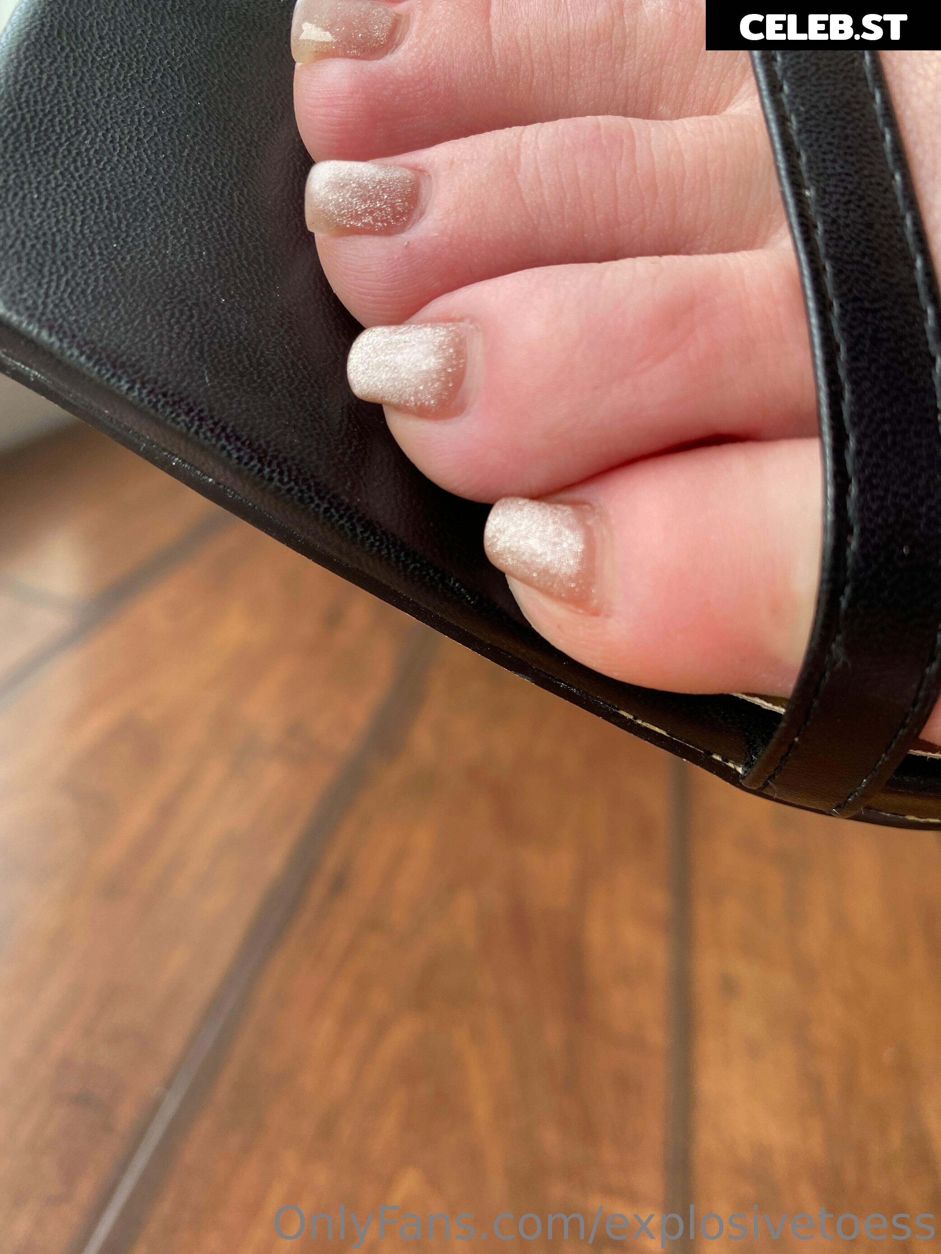 explosivetoess Image 17714774