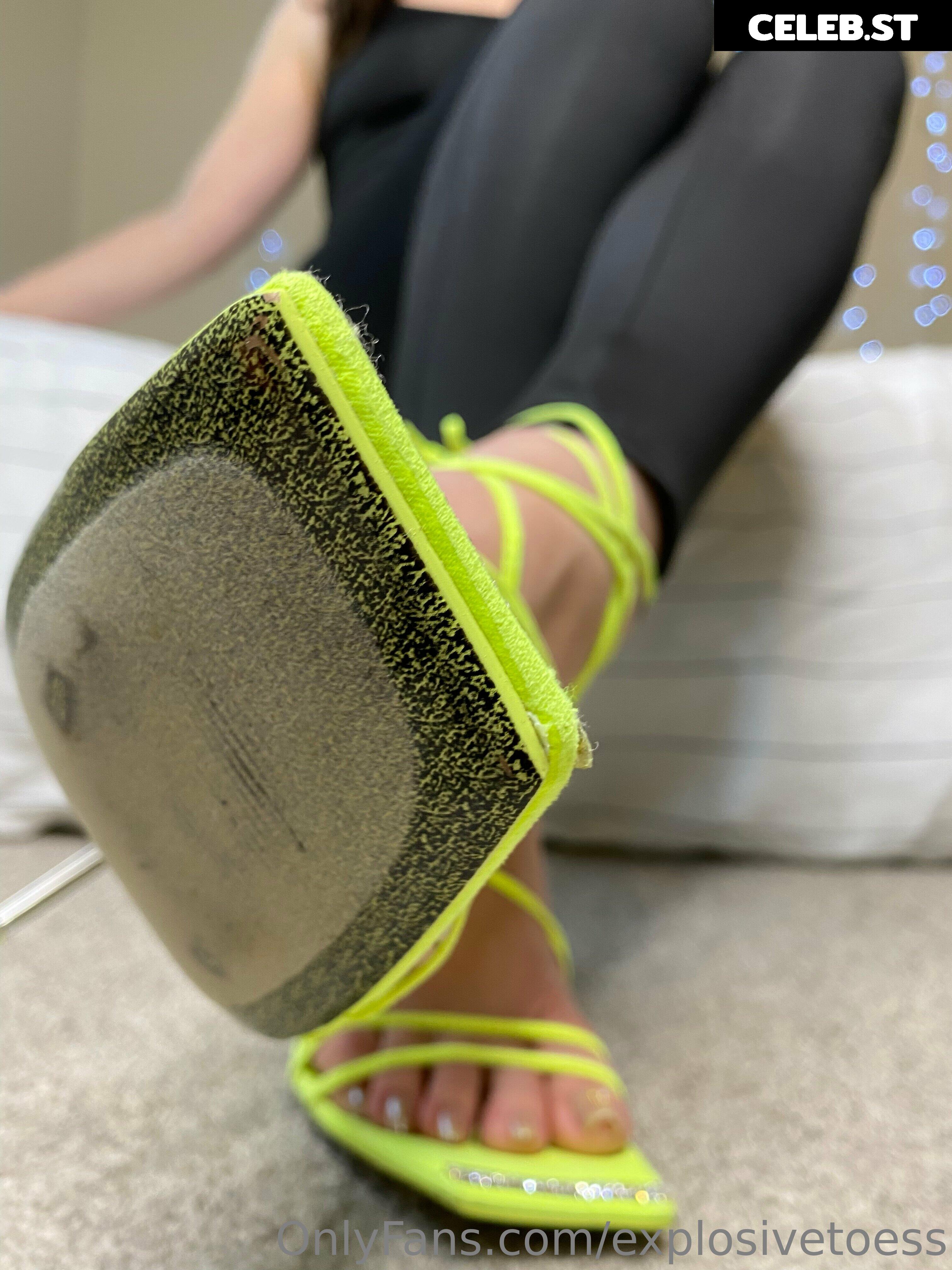 explosivetoess Image 17717486