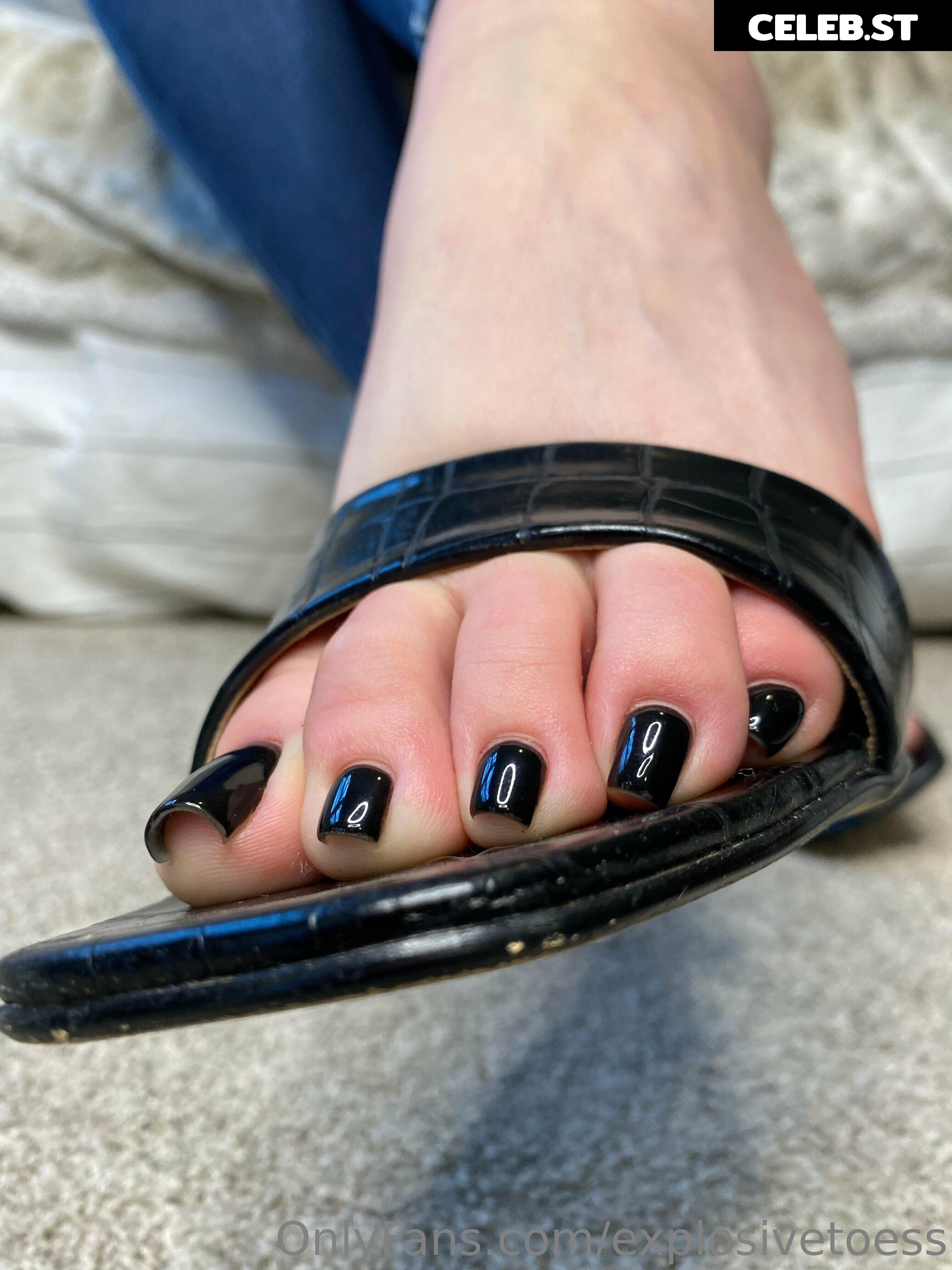 explosivetoess Image 17717061