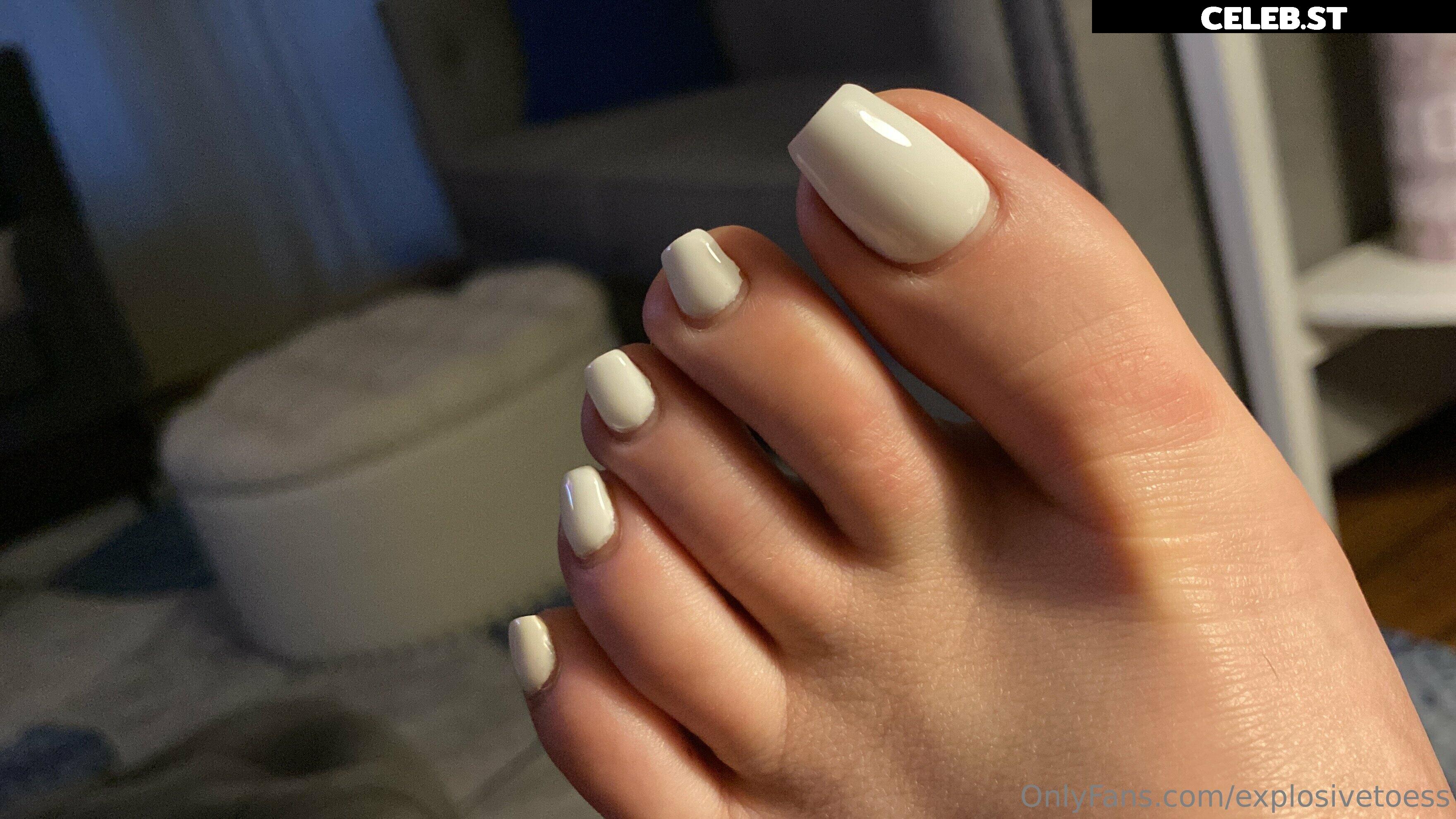 explosivetoess Image 17711820
