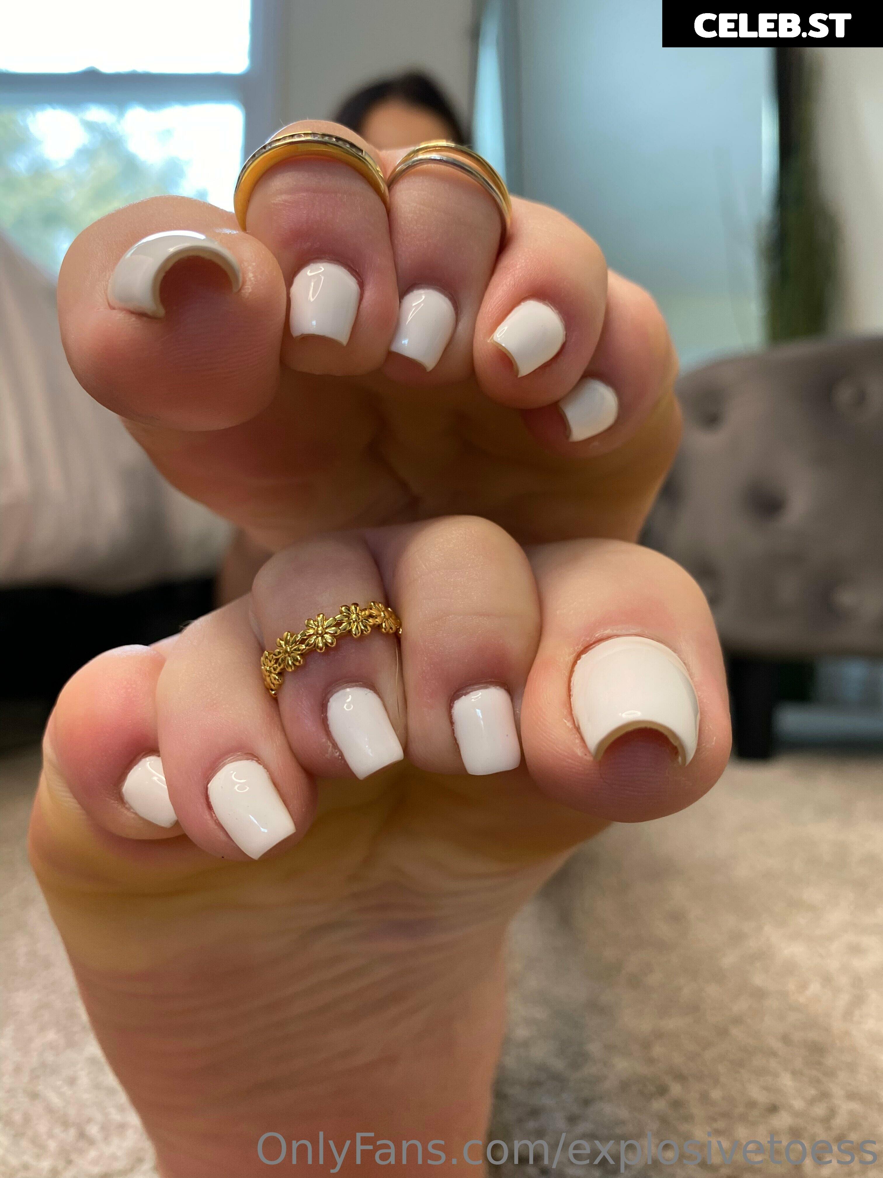 explosivetoess Image 17711494