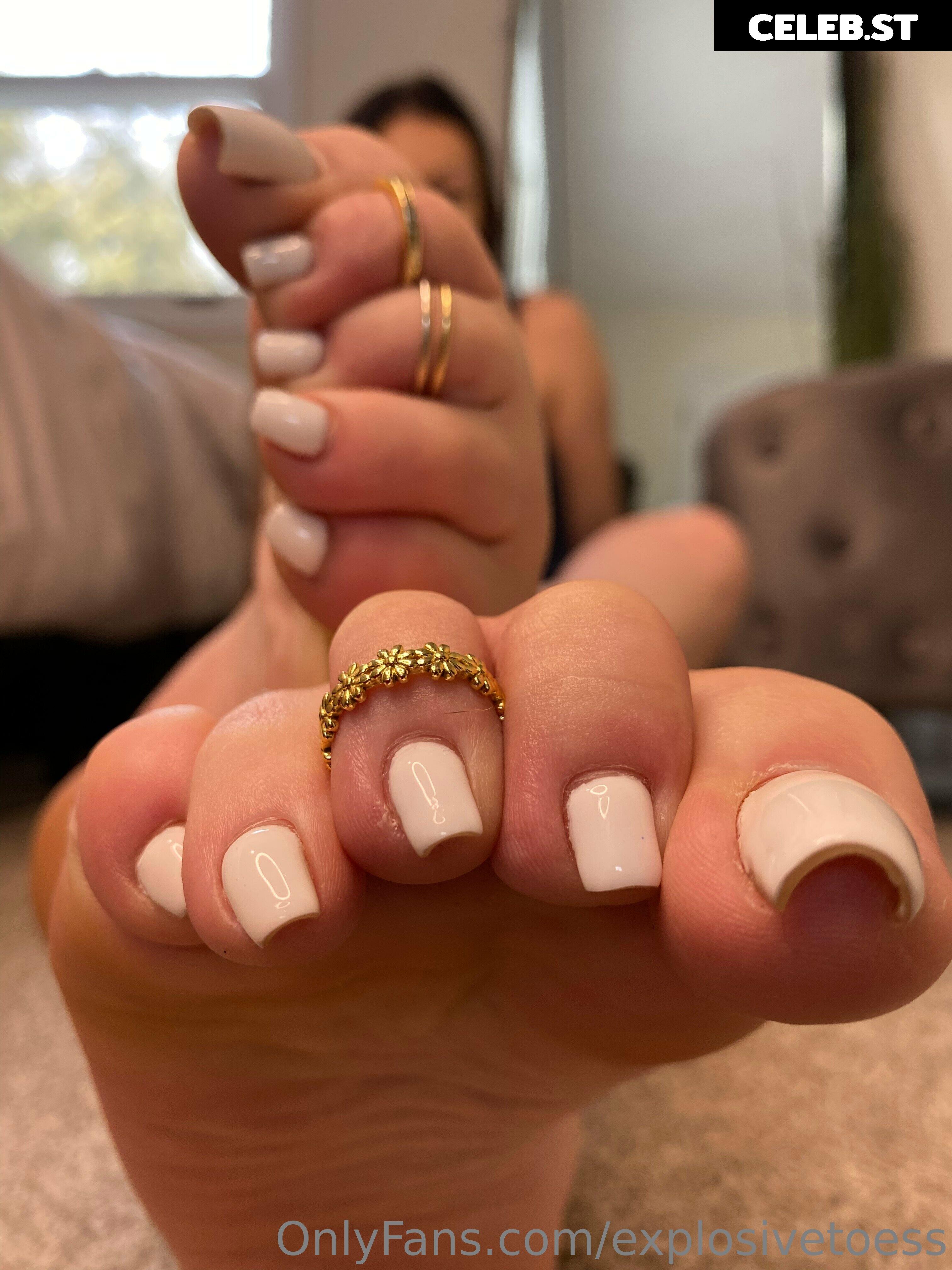 explosivetoess Image 17711622