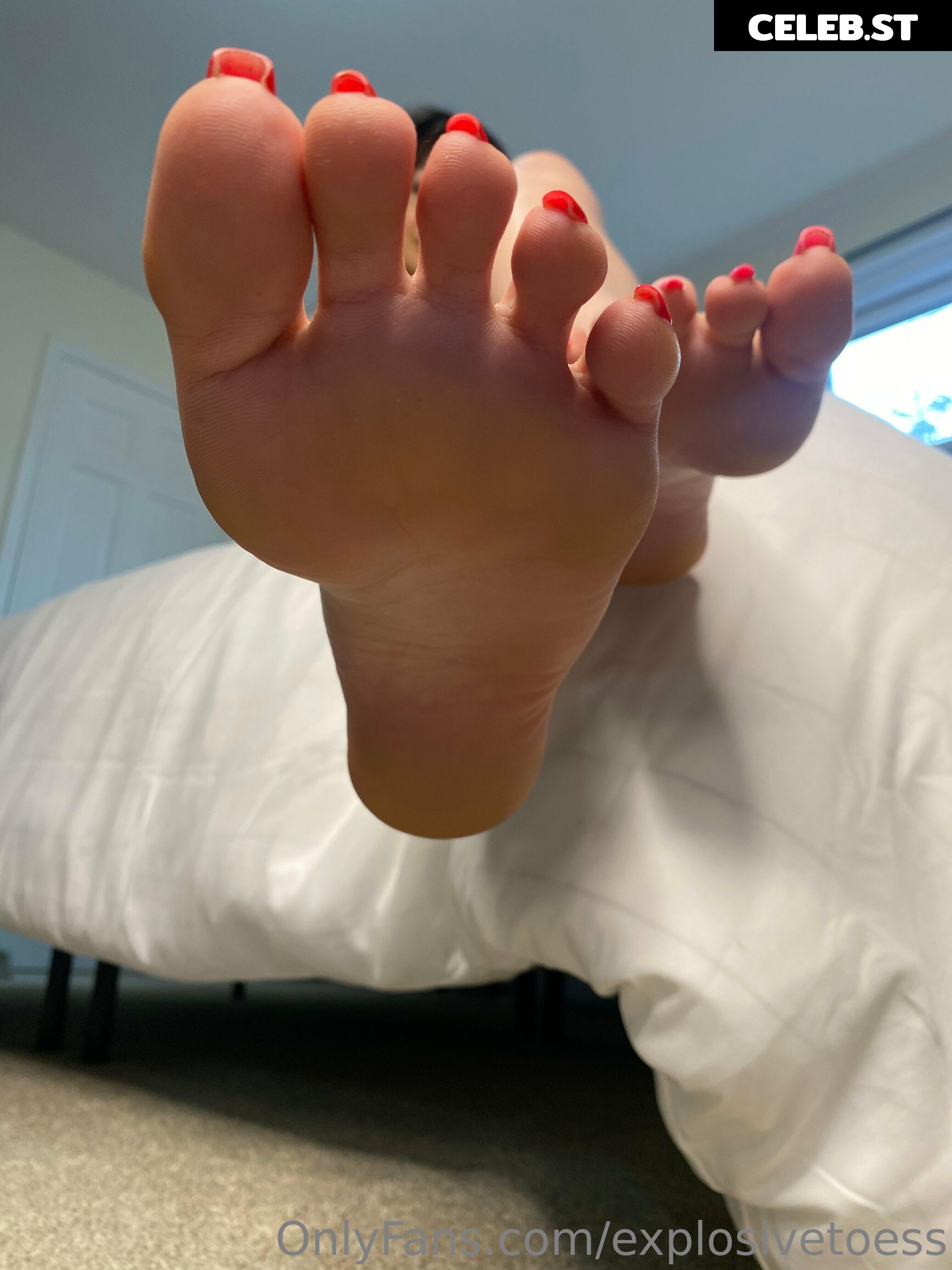 explosivetoess Image 17712912