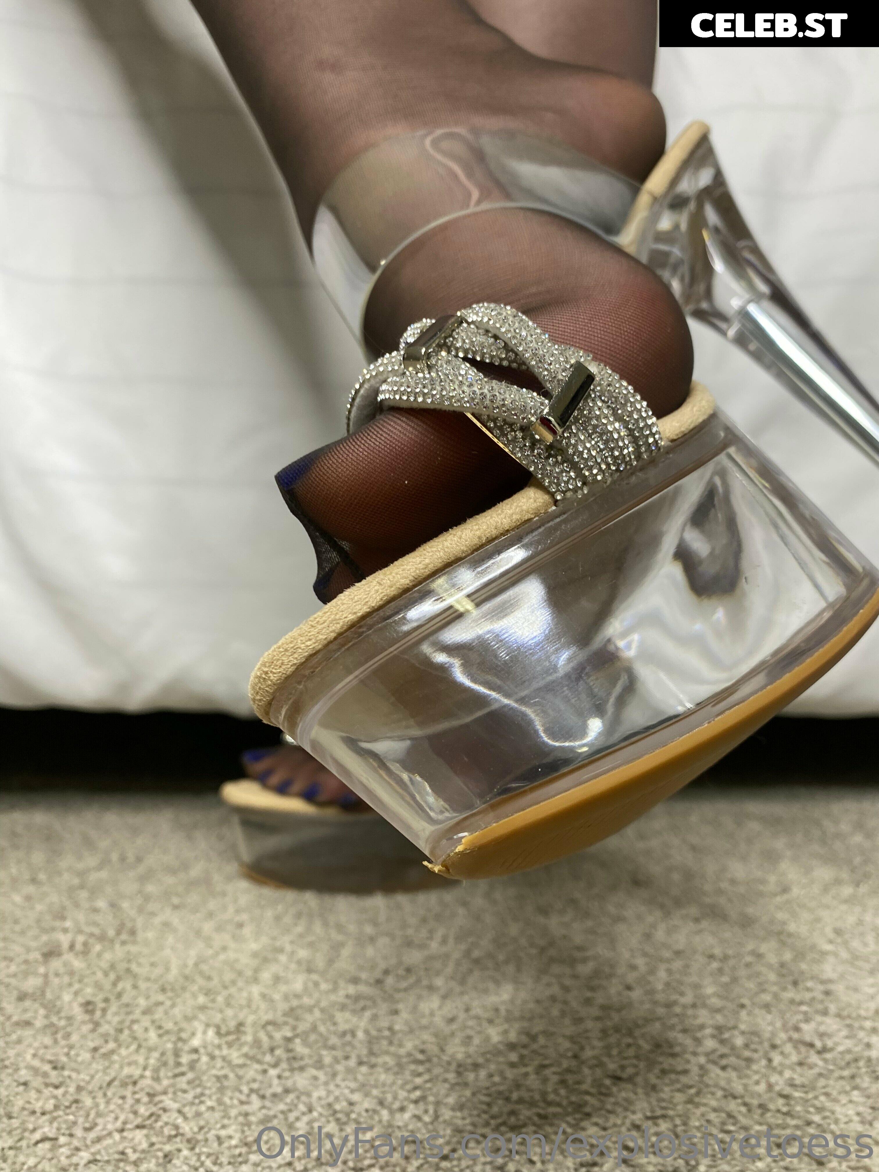 explosivetoess Image 17708111