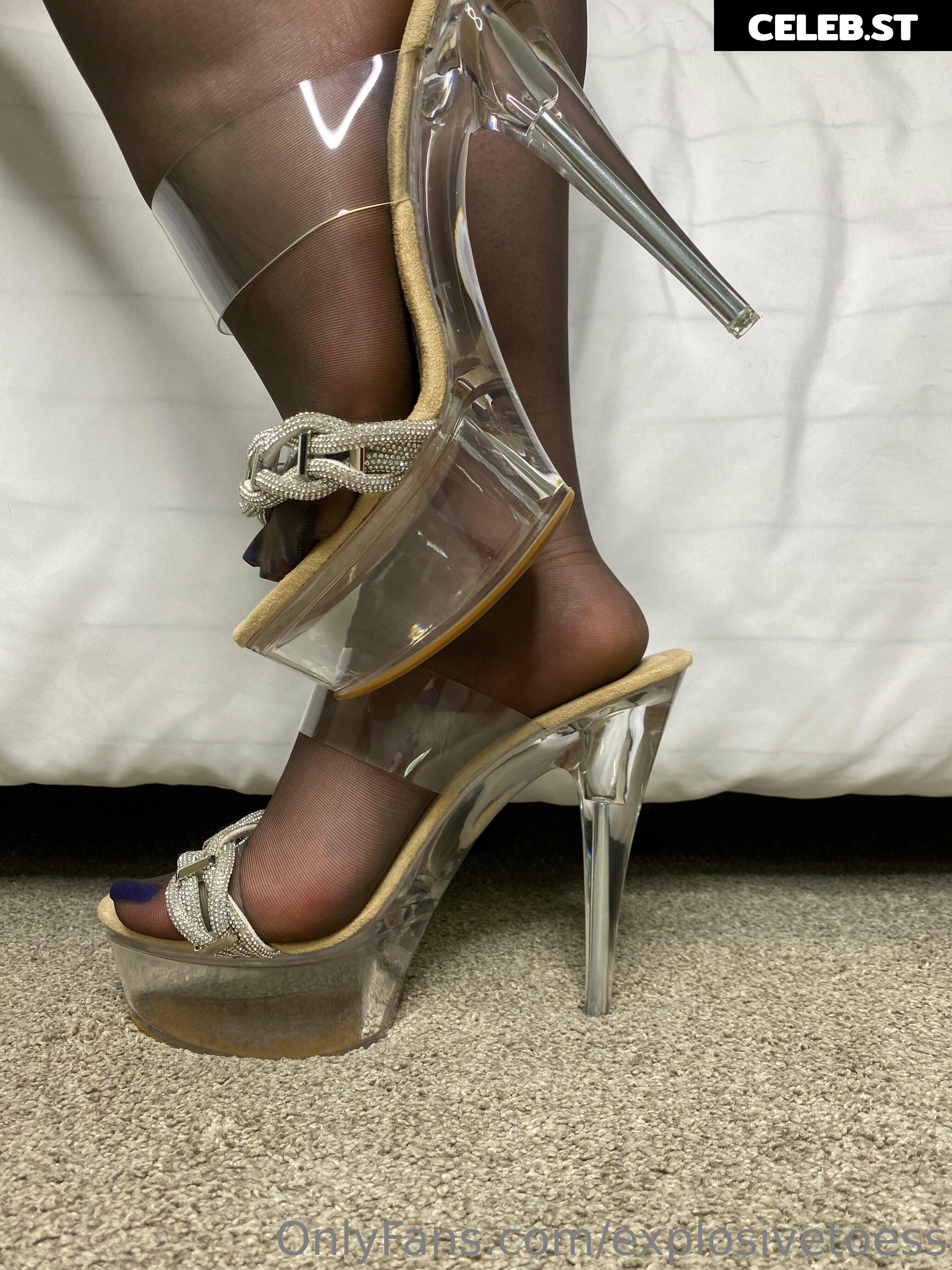 explosivetoess Image 17708317