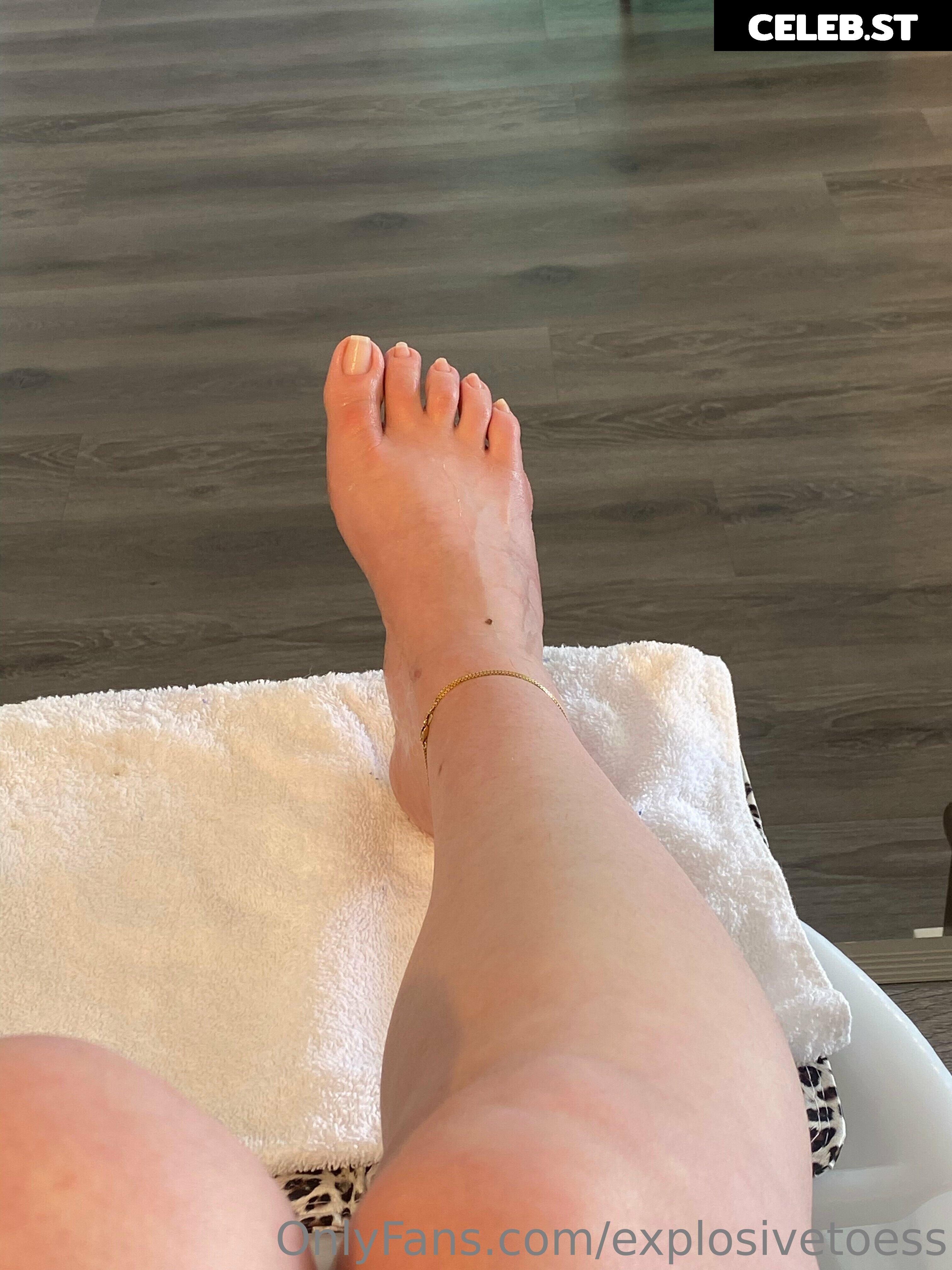 explosivetoess Image 17708309