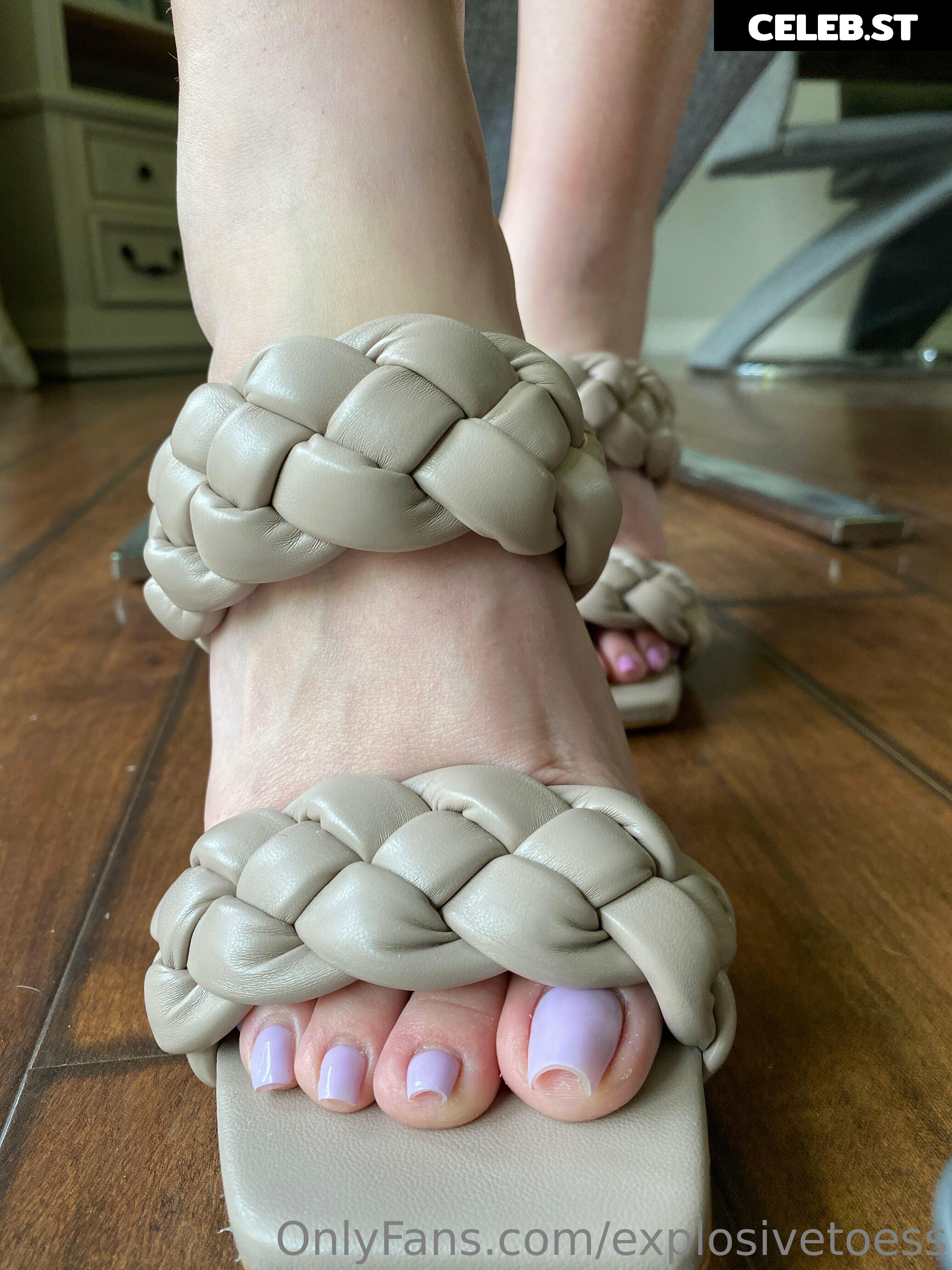 explosivetoess Image 17704080