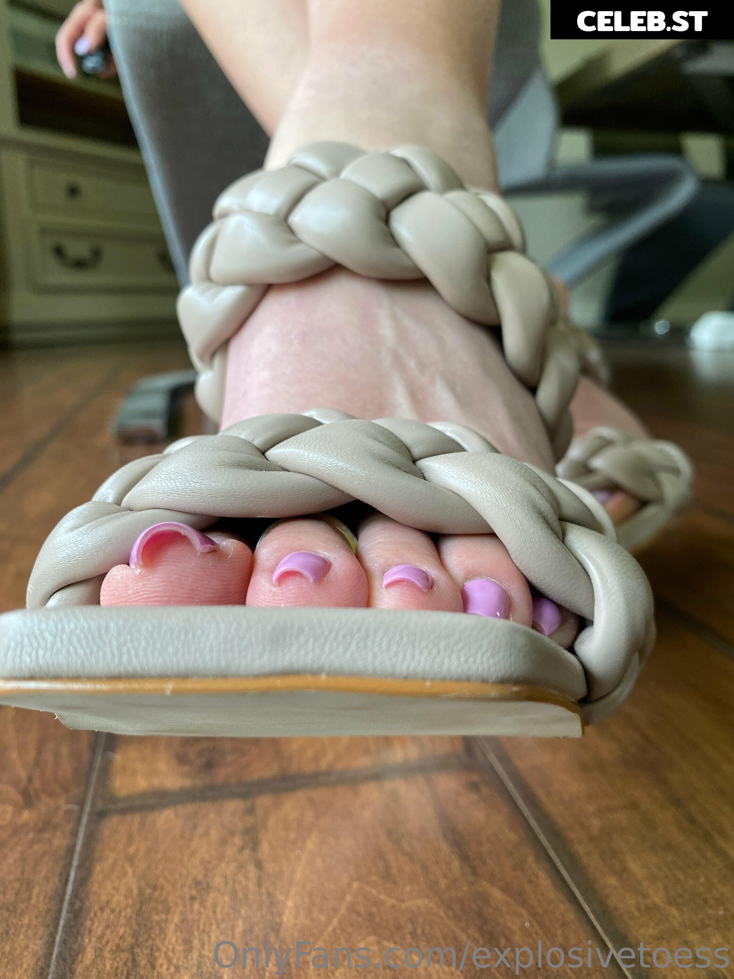 explosivetoess Image 17704395