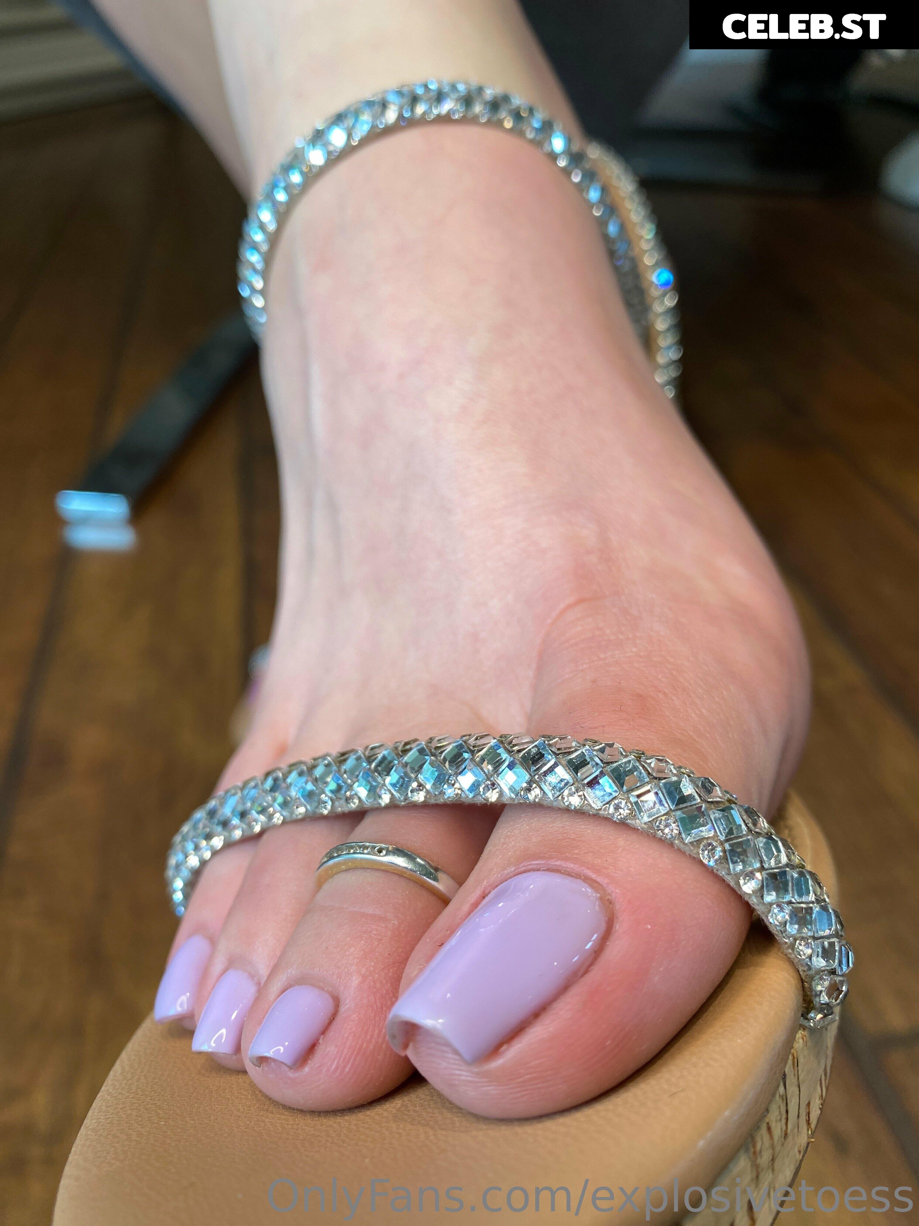 explosivetoess Image 17704378