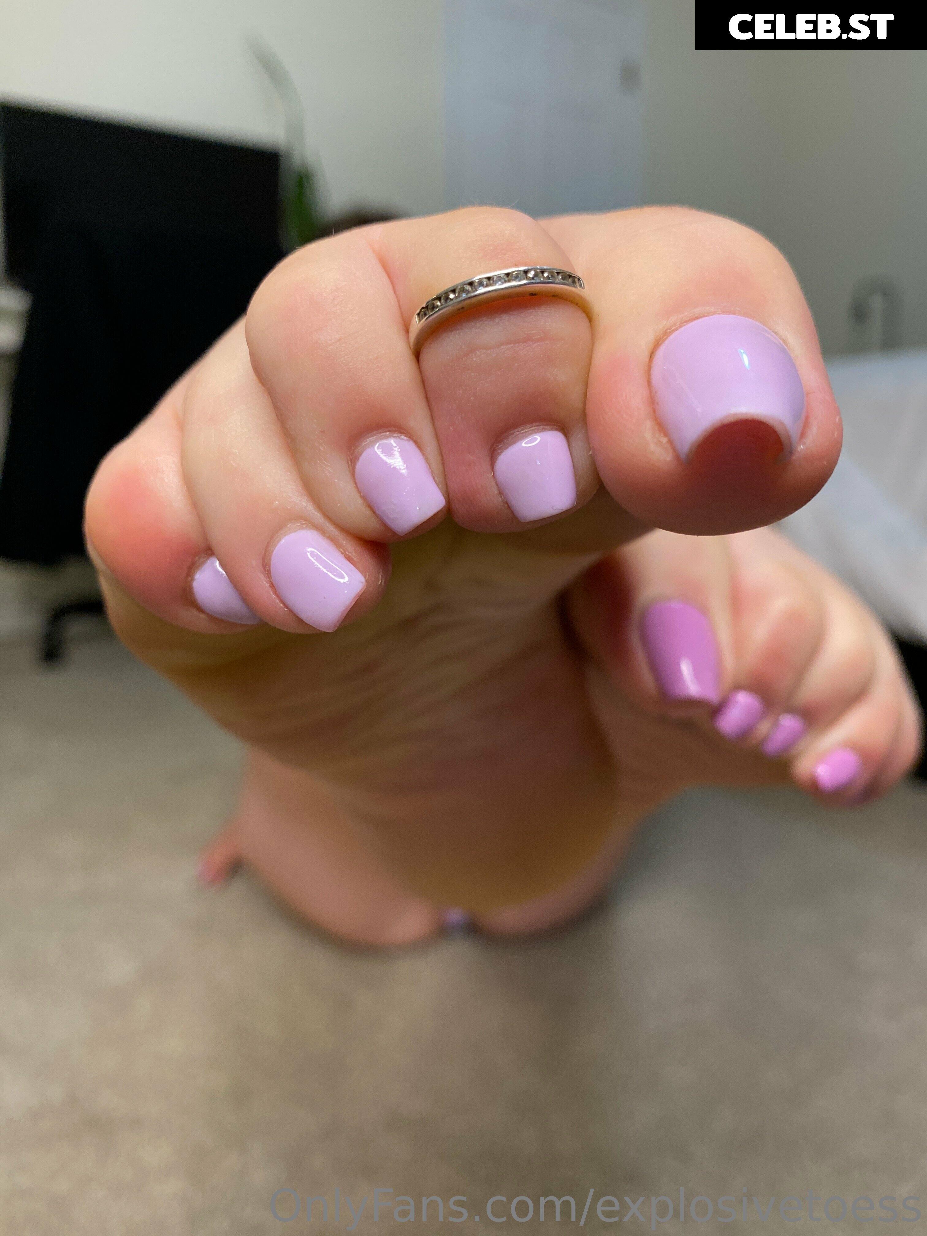 explosivetoess Image 17704298