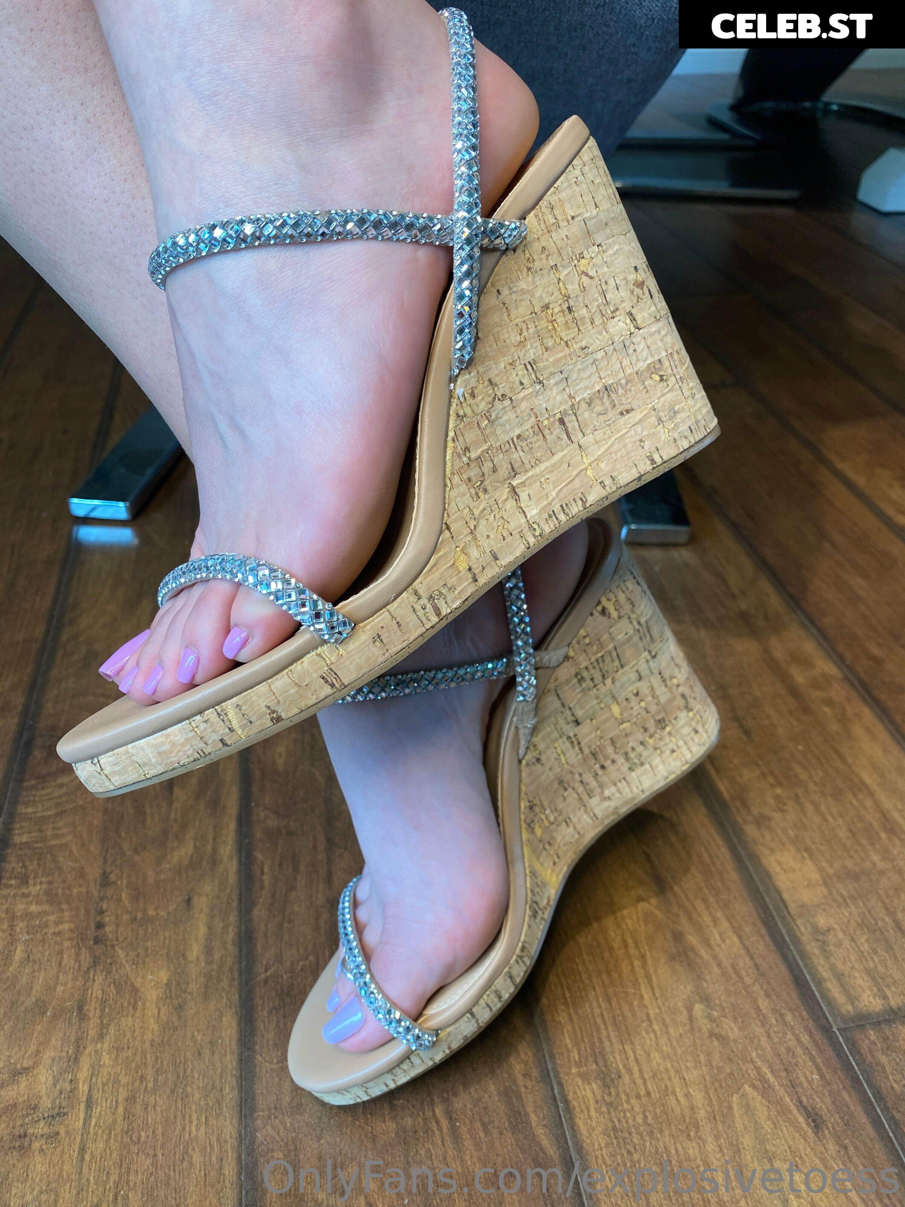 explosivetoess Image 17704271